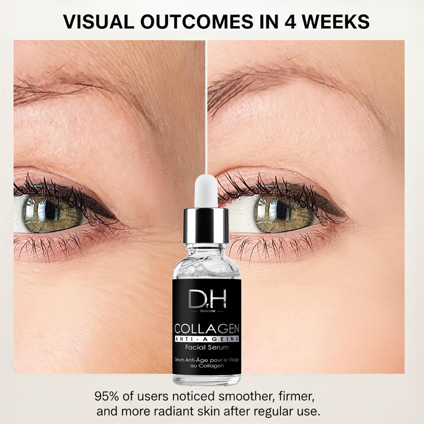 Vorher-Nachher-Vergleich von Haut mit Dr H Skincare Kollagen Anti-Aging Gesichtsserum.