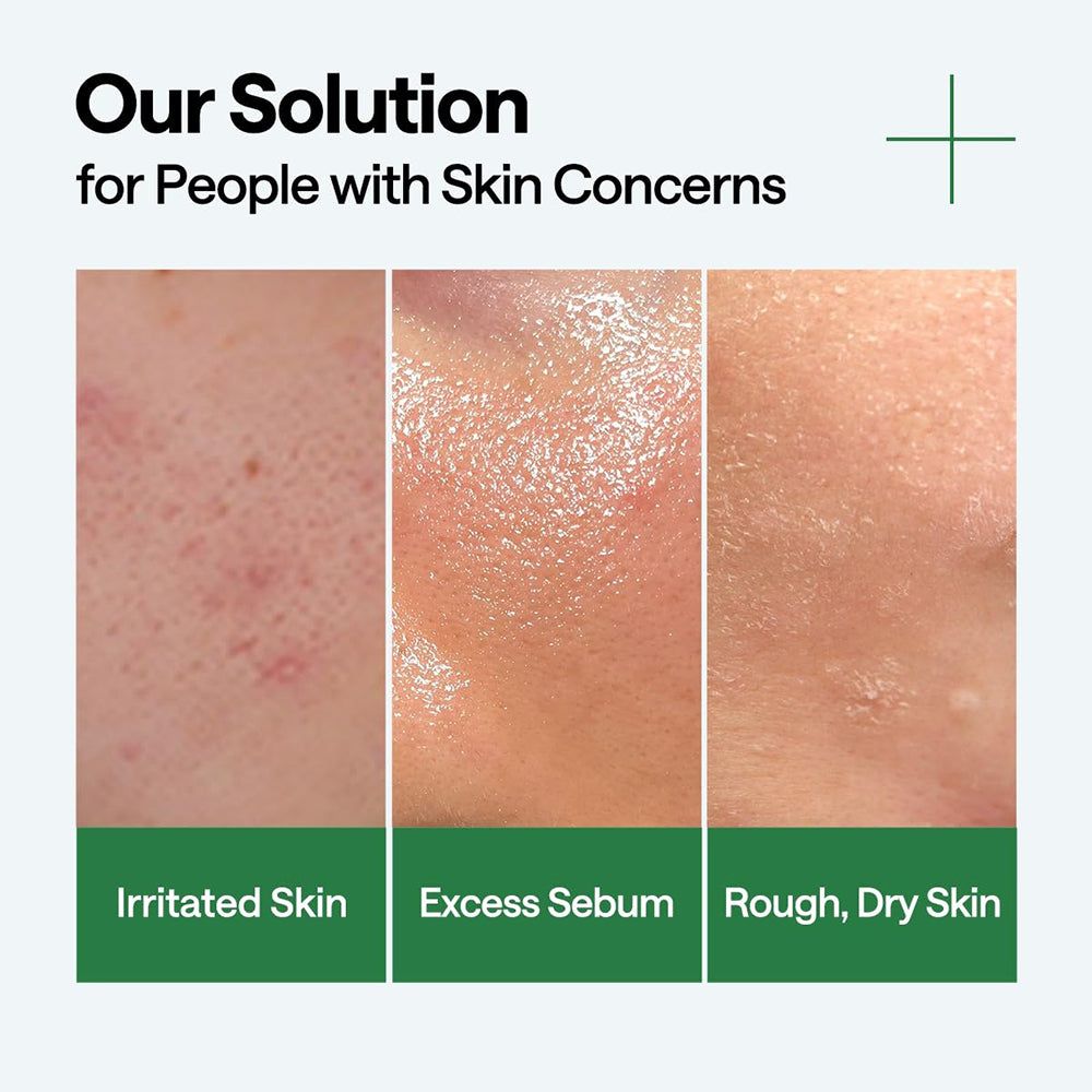 Hautbilder zeigen gereizte, ölige und trockene Haut, die mit MEDIHEAL Teebaumöl Beruhigendes Hydra-Serum behandelt wird.