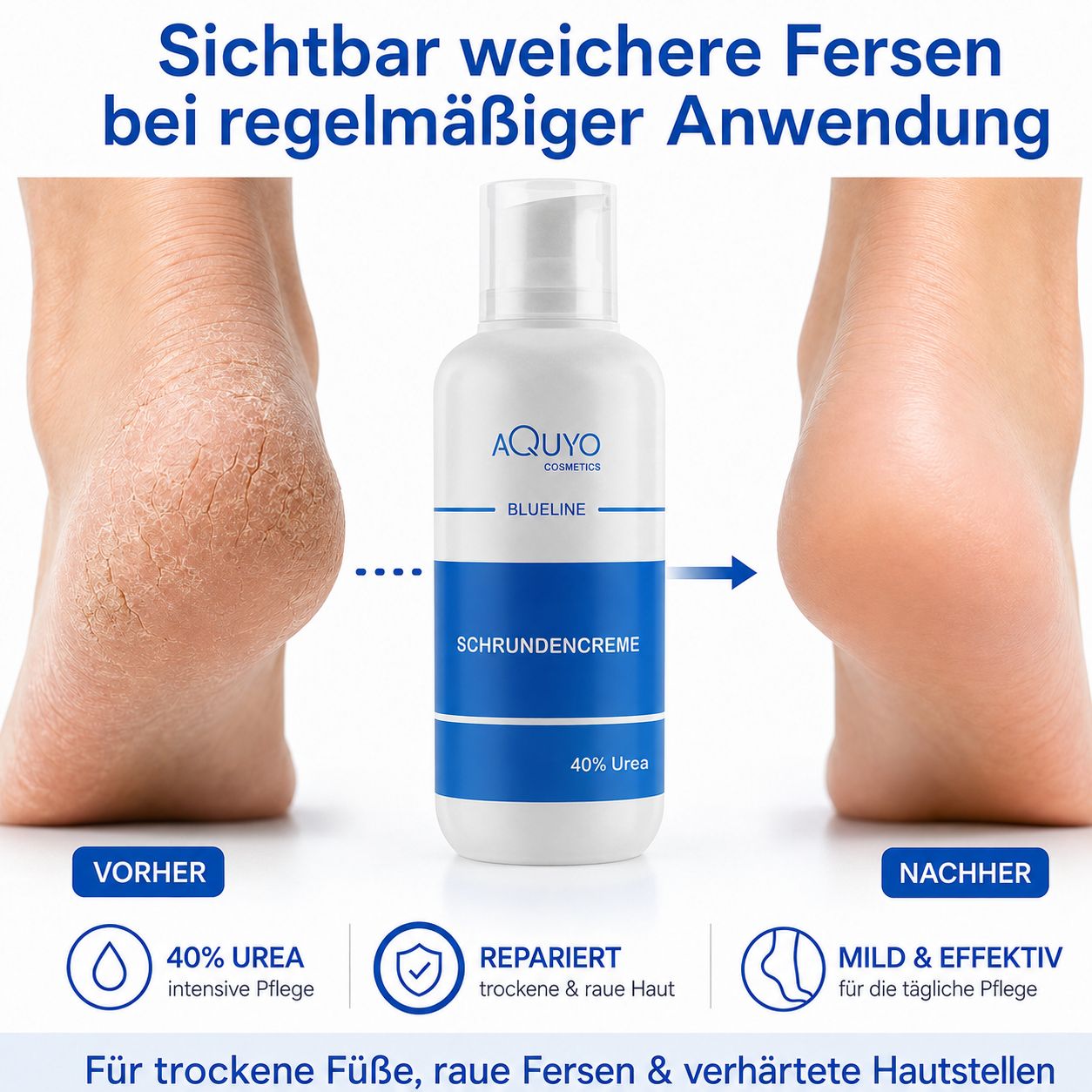 Fußcreme-Flasche mit blauem Streifen. Vorher-Nachher-Vergleich von Füßen. Text: Schrundencreme, 40% Urea.