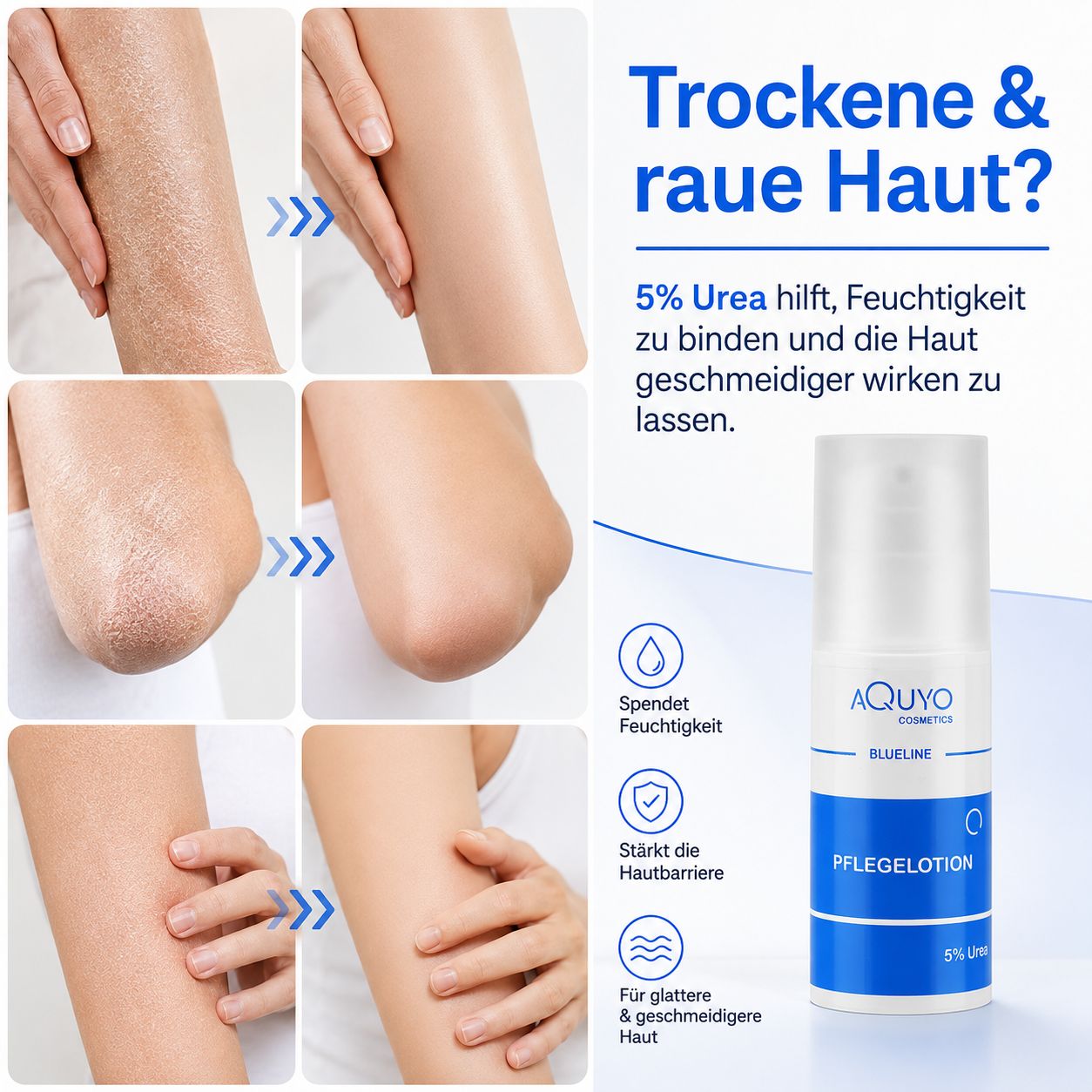 Produktabbildung: Blueline Pflegelotion. Illustrationen zeigen Hautveränderungen. Text: 5% Urea für Feuchtigkeit. Aquyo Cosmetics Logo.