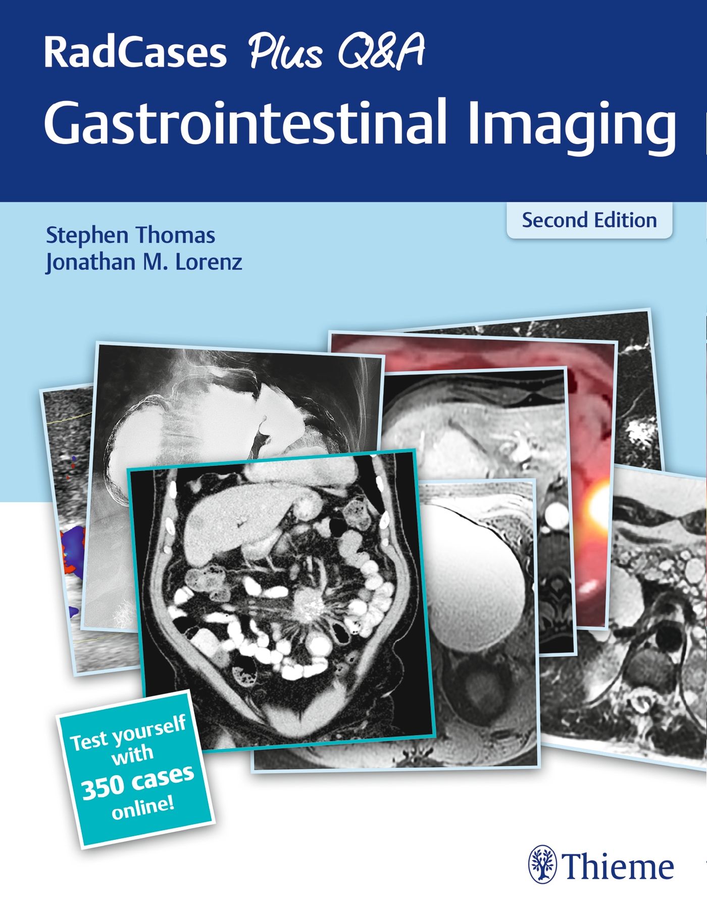 Buchcover mit dem Titel "RadCases Plus Q&A Gastrointestinal Imaging". Autoren: Stephen Thomas, Jonathan M. Lorenz. Zweite Auflage. Abbildungen von medizinischen Scans.