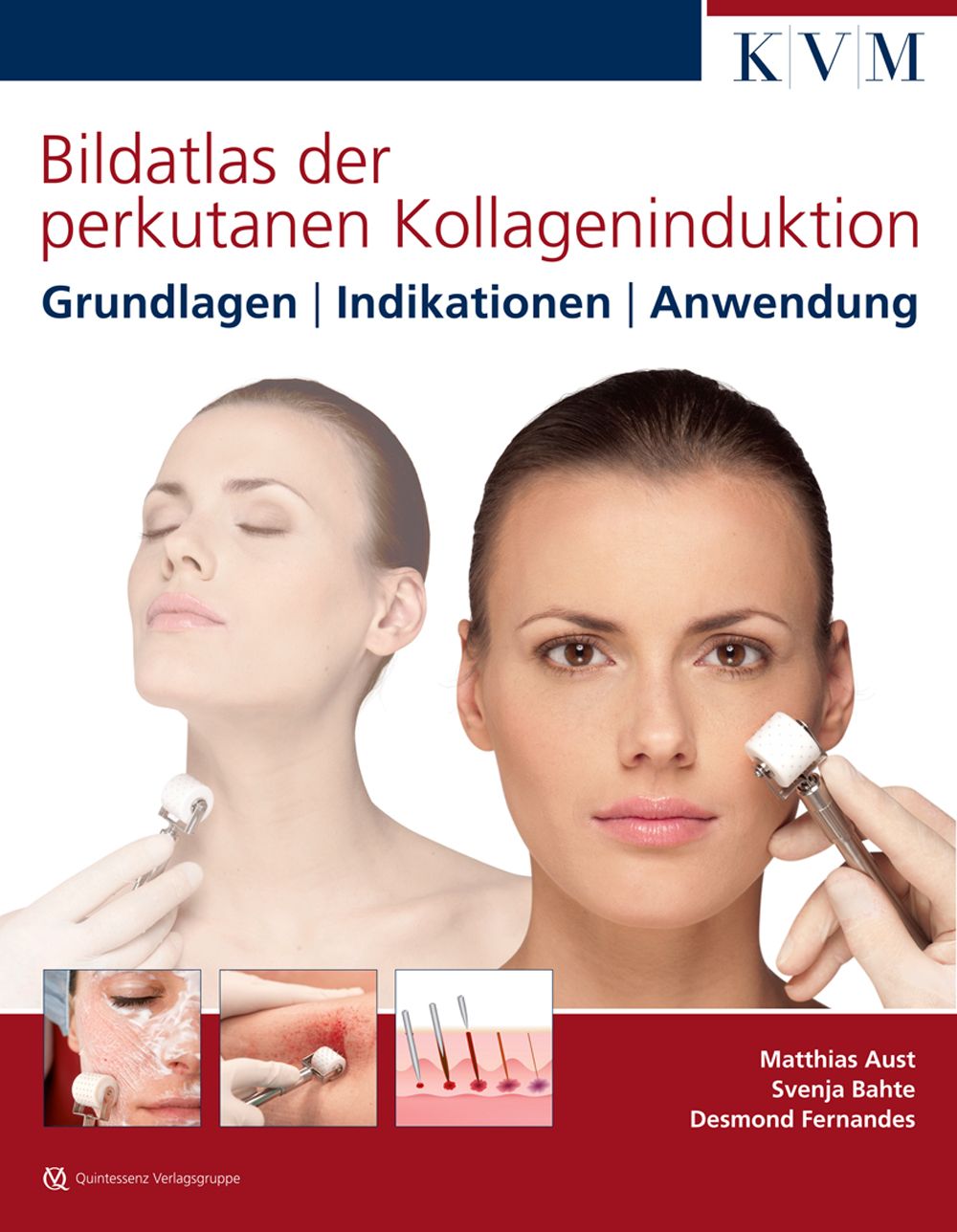 Buchcover: Bildatlas der perkutanen Kollageninduktion. Grundlagen, Indikationen, Anwendung. Autoren: Aust, Bahte, Fernandes.