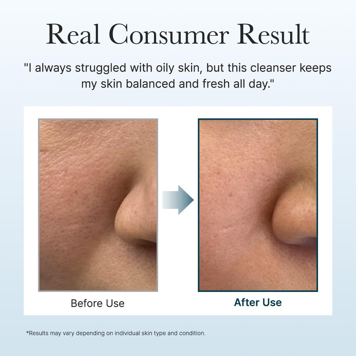 Vorher-Nachher-Vergleich. Gesichtshaut vor und nach der Anwendung. Text: Real Consumer Result. Ergebnisse können variieren.