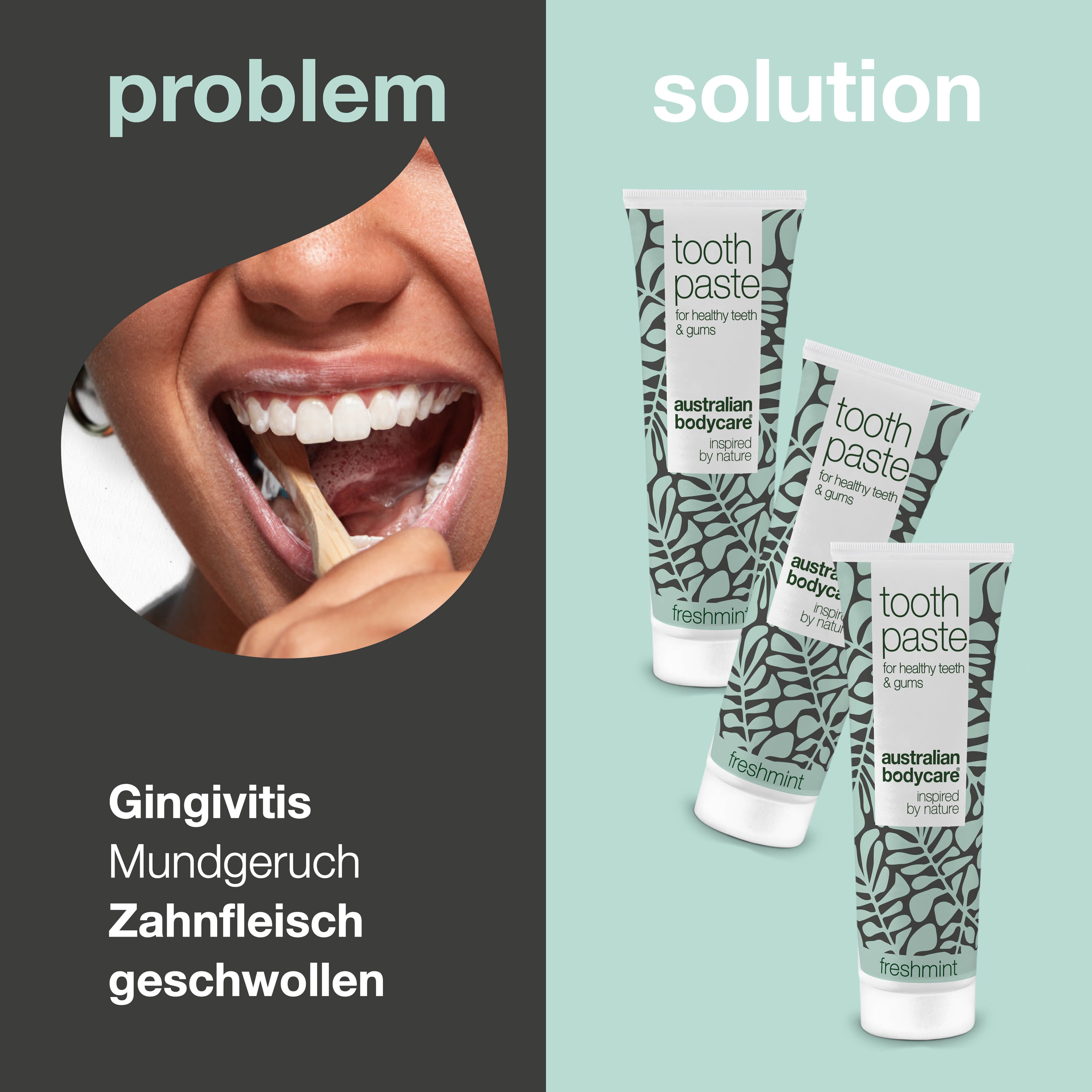 Zahnpasta-Tuben und Zähne putzende Person. Text: Gingivitis, Mundgeruch, Zahnfleisch geschwollen.
