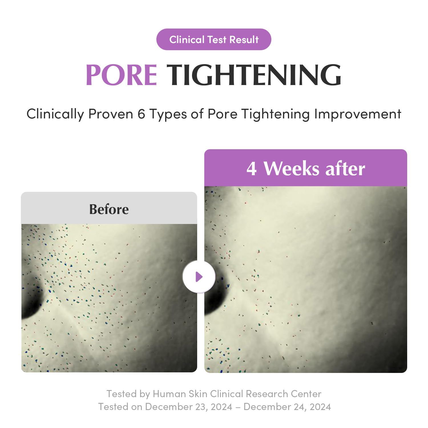 EQQUALBERRY Purple PDRN Pore Minimizing Serum