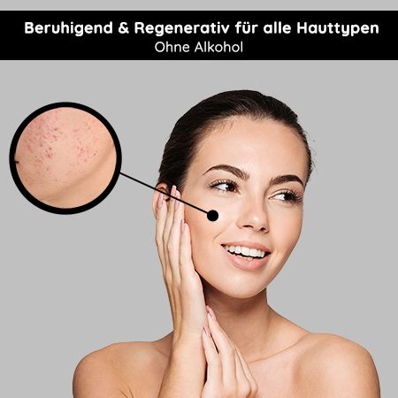 RAU Cosmetics Tonic alcoholfrei - Toner mit Brennnessel-Extrakt für unreine, fettige & reife Haut