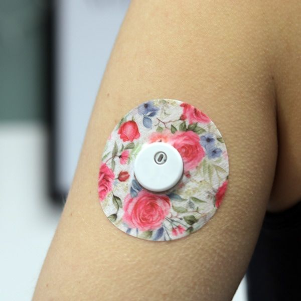 Arm mit angebrachtem Fixierpflaster. Rosenmuster. CGM-Sensor in der Mitte. Für CGM-Sensoren und Insulinpumpen.