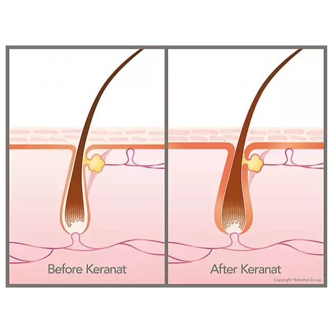 Vergleich von Haarzellen vor und nach der Behandlung. Beschriftung: Before Keranat, After Keranat.