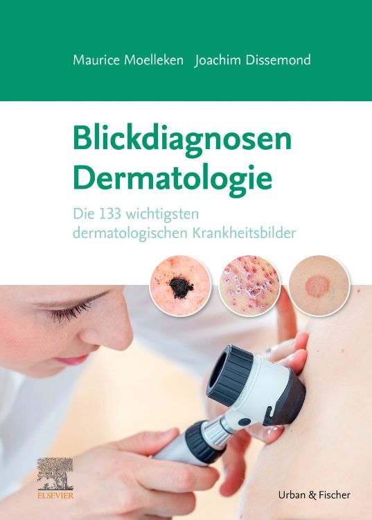 Buchcover: Blickdiagnosen Dermatologie. Titel, Autoren, dermatologische Krankheitsbilder und ein Dermatoskop. Verlag Urban & Fischer, Elsevier.