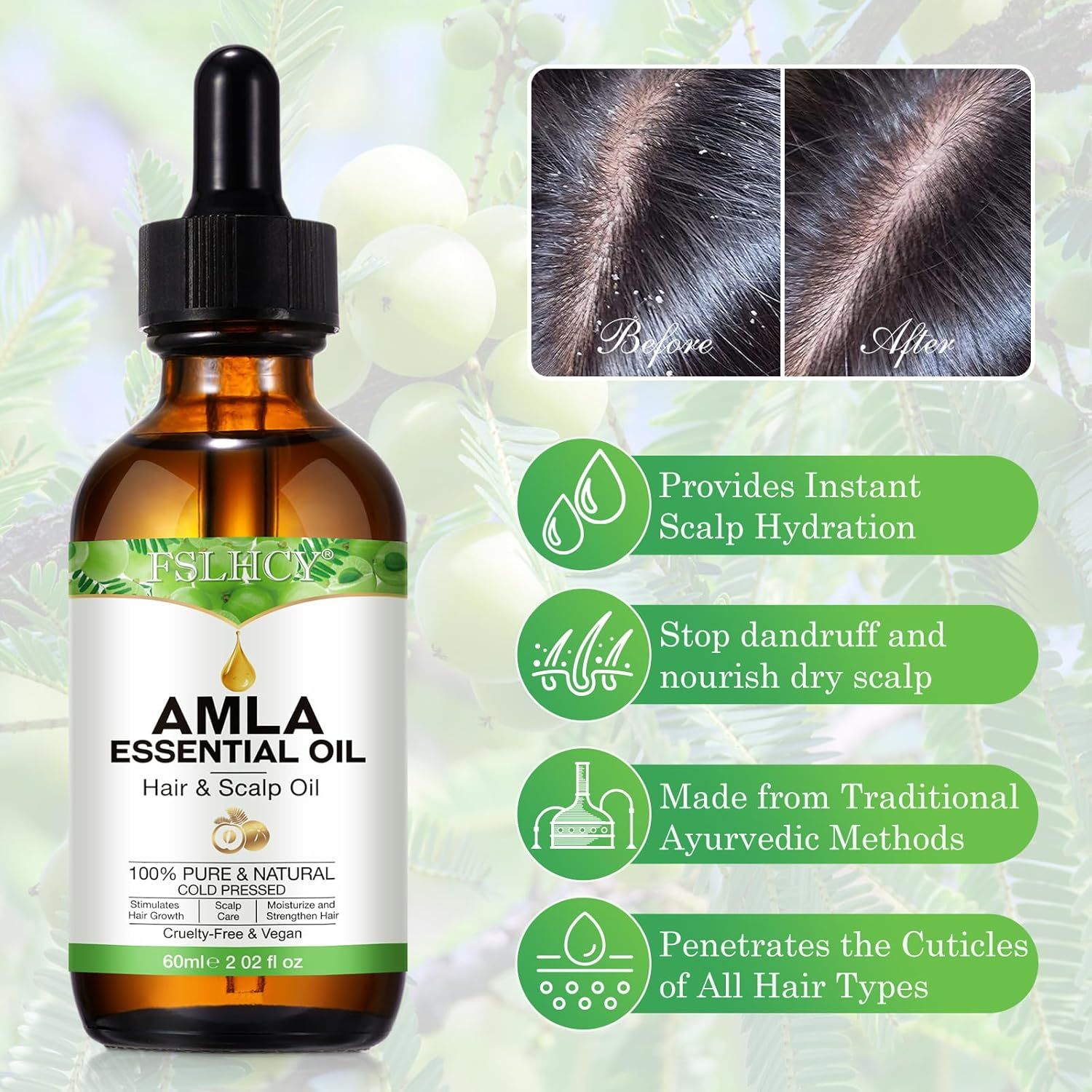 Braune Flasche mit Tropfer. Aufschrift: Amla Essential Oil, Hair & Scalp Oil. Bilder: Kopfhaut vor und nach der Anwendung. Text: Stoppt Schuppen.