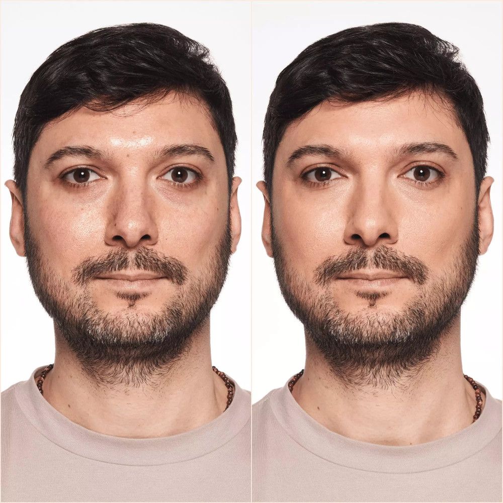 Vorher-Nachher-Vergleich. Mann mit und ohne Foundation. Deutliche Verbesserung des Hautbildes.