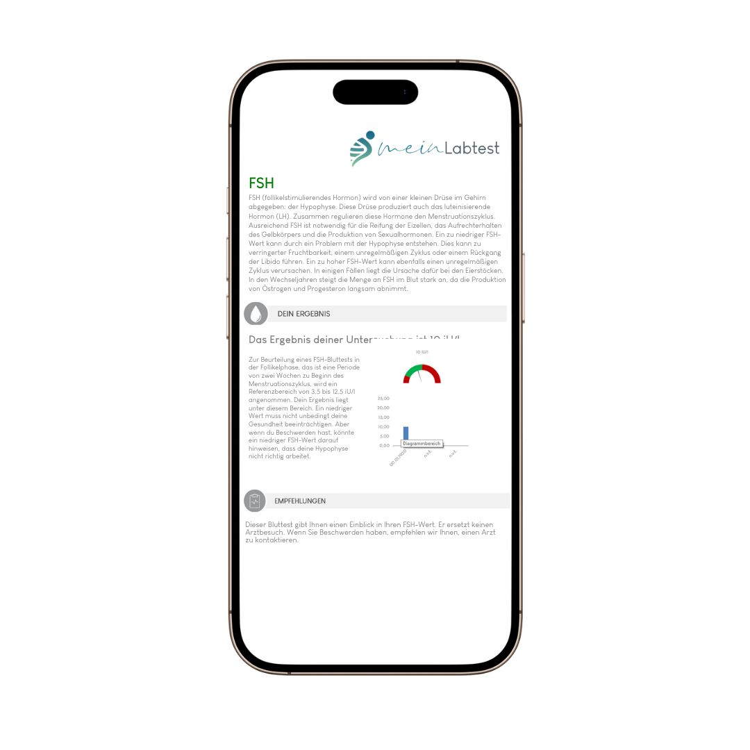 Smartphone mit FSH-Testergebnis von meinLabtest. Auf dem Bildschirm sind Informationen und Diagramme zu sehen.