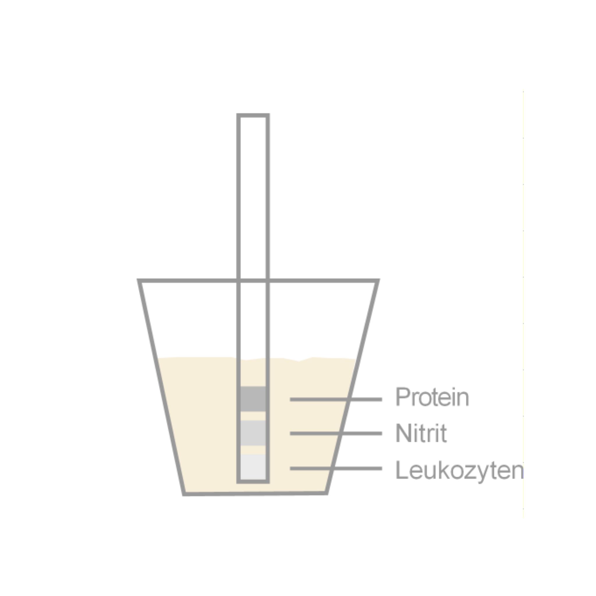 Becher mit Flüssigkeit und Teststreifen. Markierungen: Protein, Nitrit, Leukozyten.