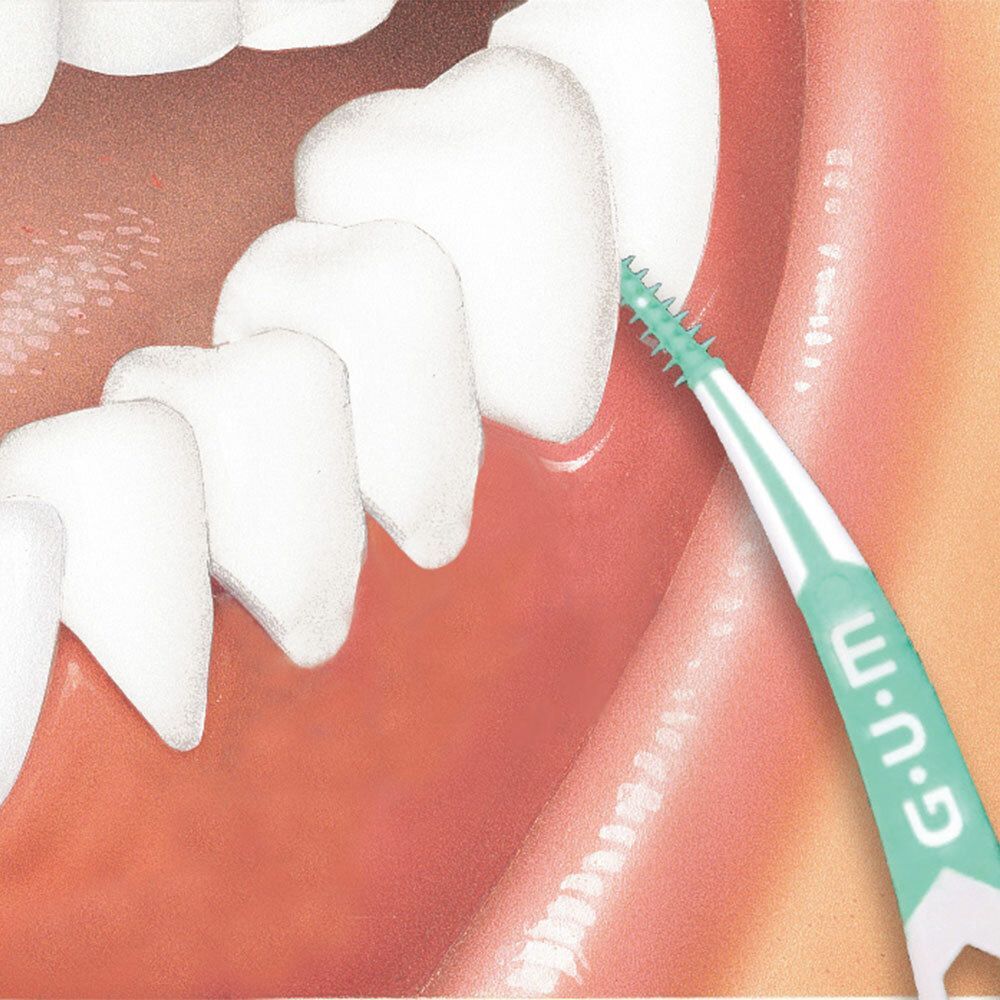 Illustration eines Mundes mit Zähnen. Eine Interdentalbürste wird zwischen den Zähnen verwendet. Marke G.U.M.