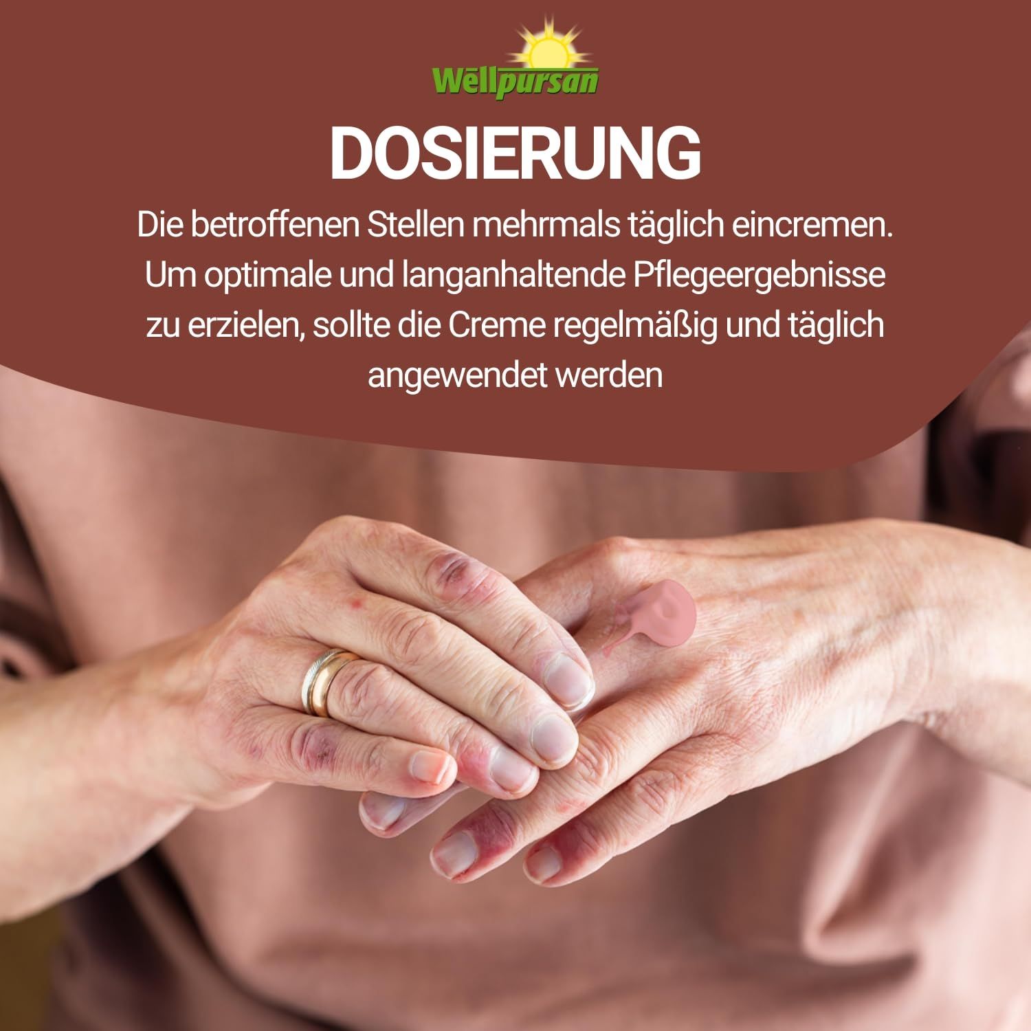 Hände mit Hautirritationen. Text: "DOSIERUNG". Text beschreibt die Anwendung der Creme. Regelmäßige Anwendung empfohlen.