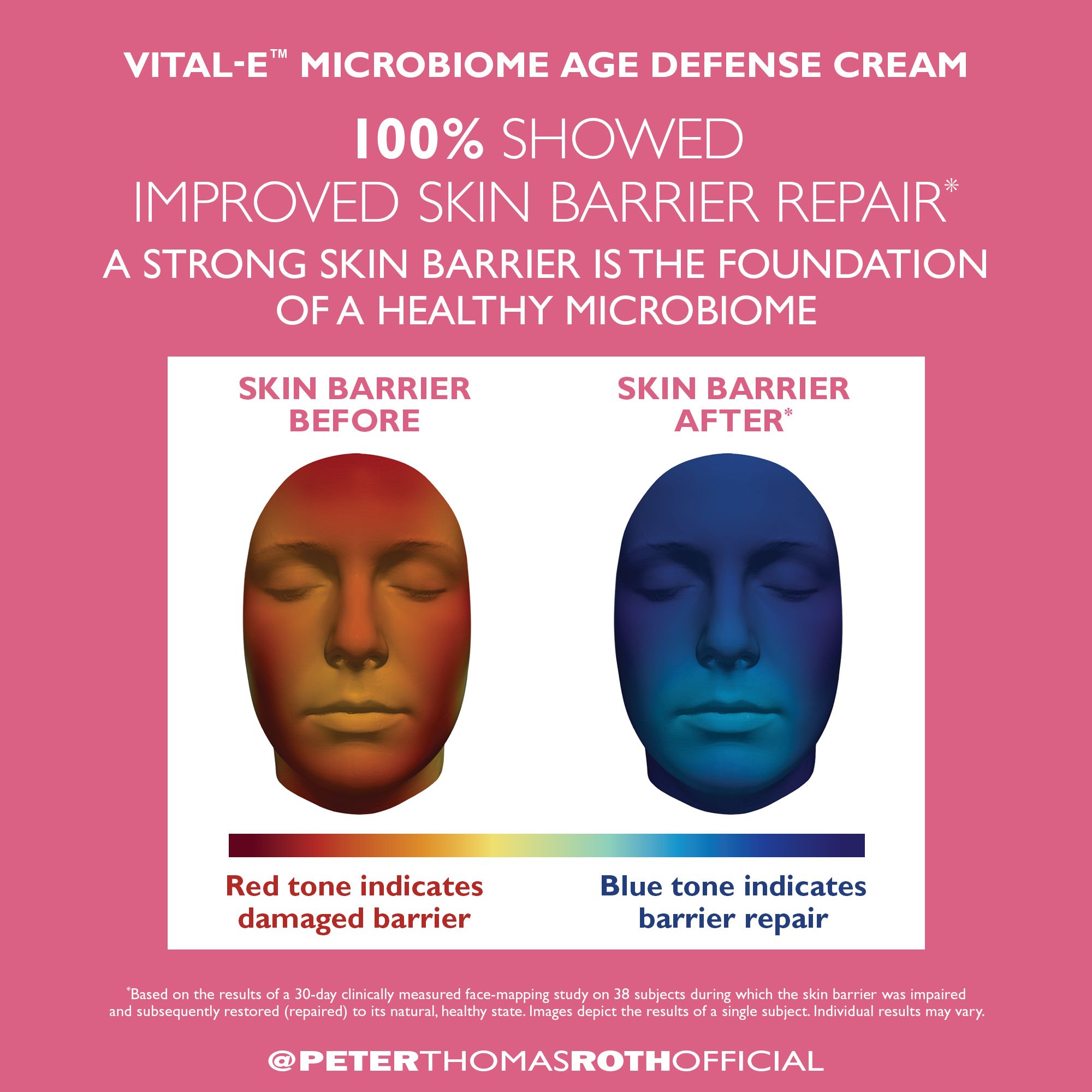 Grafik mit Gesichtern vor und nach der Anwendung. Text: Vital-E Microbiome Age Defense Cream. 100% verbesserte Hautbarriere.