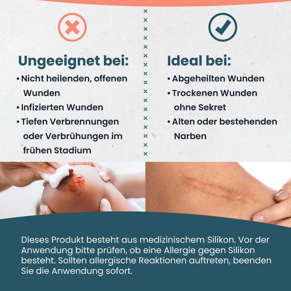 Tampen Hydrokolloidpflaster: Ideal für abgeheilte Narben, ungeeignet bei offenen oder infizierten Wunden.