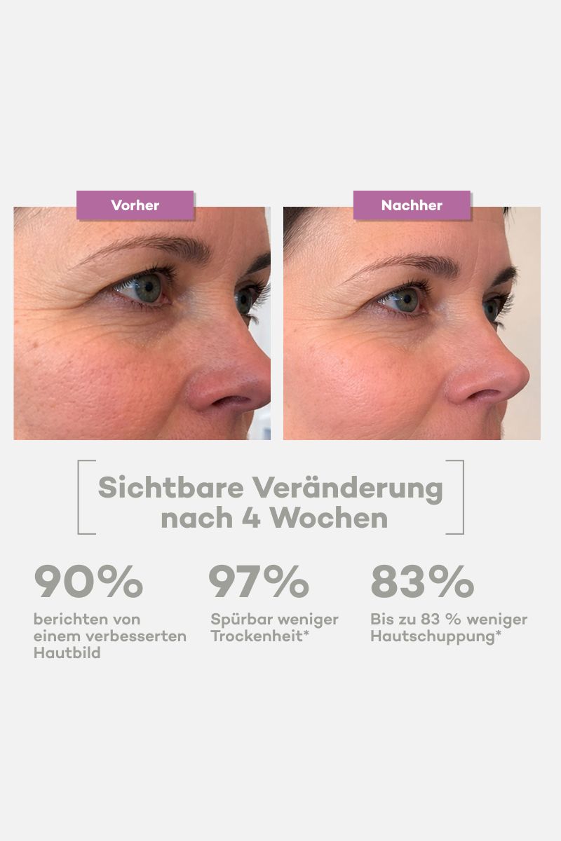 Tallow Barrier Repair Lavendel – Creme bei Neurodermitis & Ekzem – Bio Rindertalg (120ml)