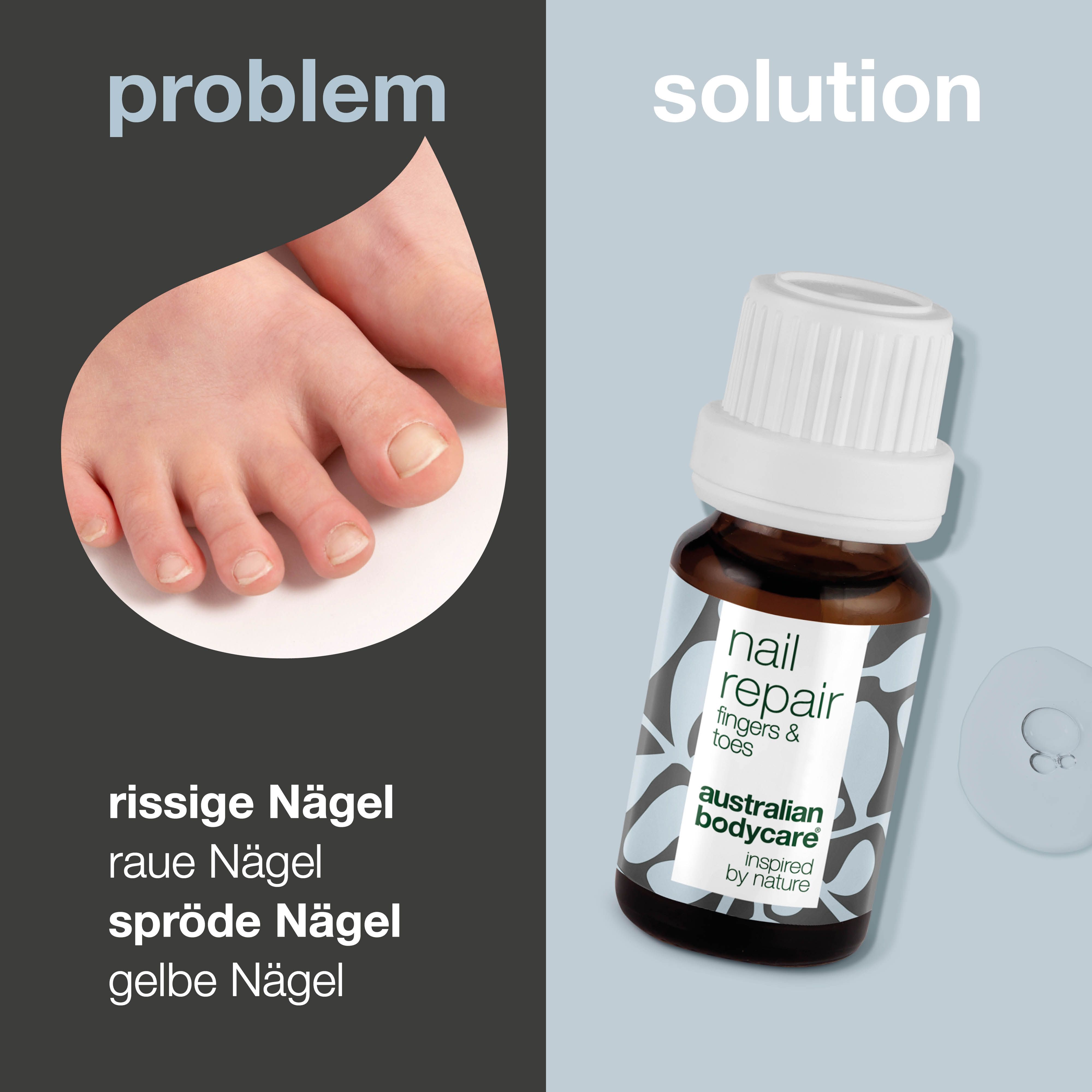 Problem-Lösung-Darstellung. Fuß mit Nagelproblemen. Flasche "nail repair" und "australian bodycare".