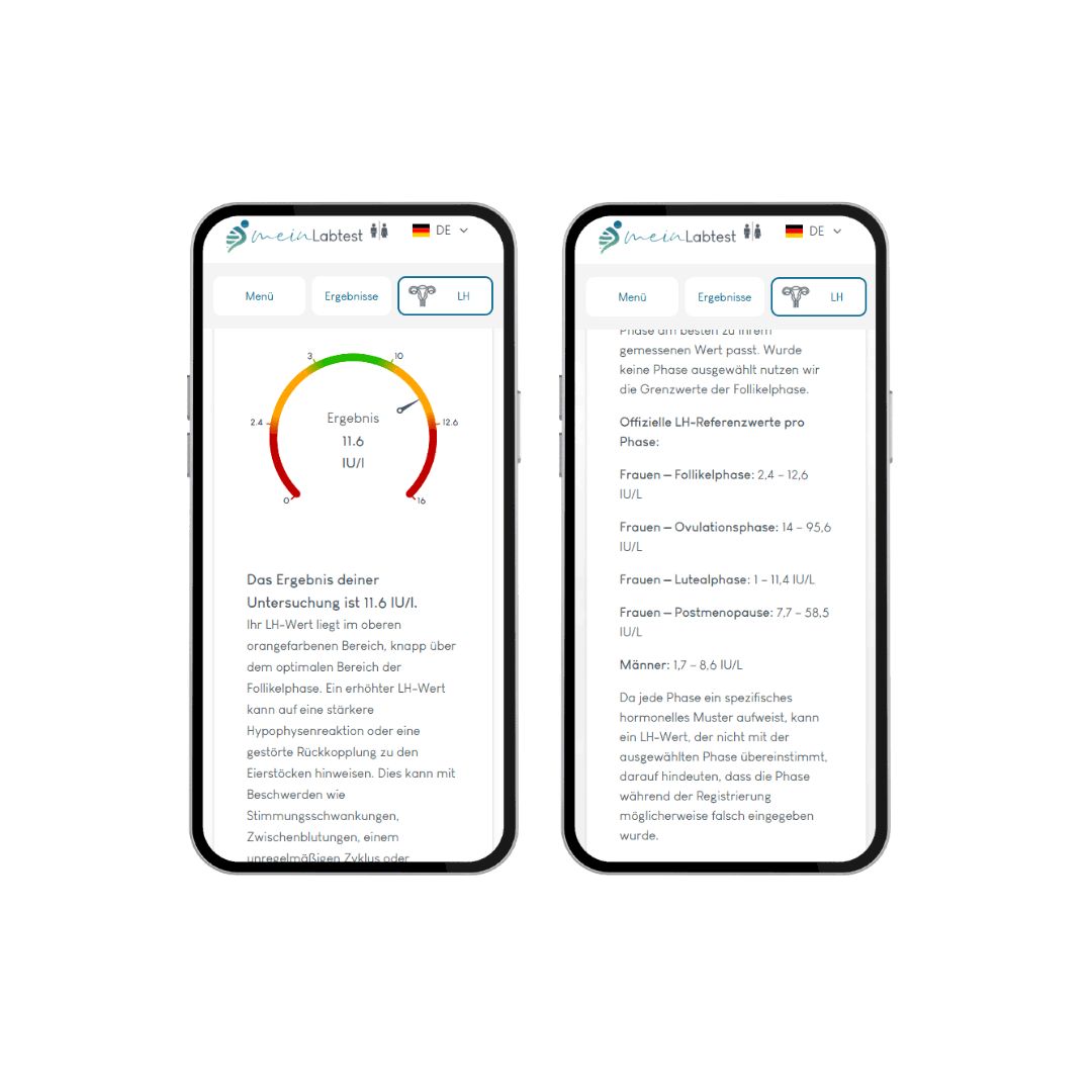 Zwei Smartphones mit Testergebnissen. Auf dem Bildschirm: Ergebnisse, Diagramme. Logo: meinLabtest. Sprache: Deutsch.