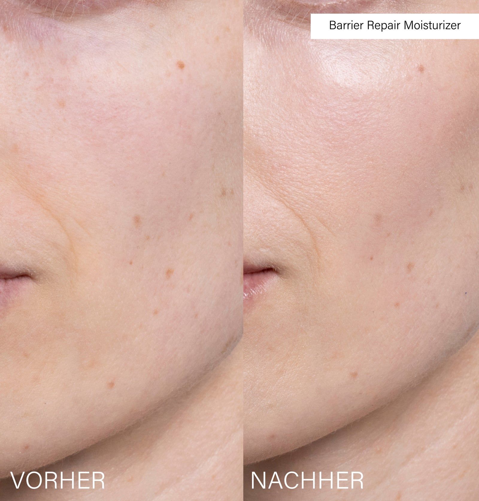 Gesicht, Vorher-Nachher-Vergleich. Links: Haut vor der Anwendung. Rechts: Haut nach der Anwendung.