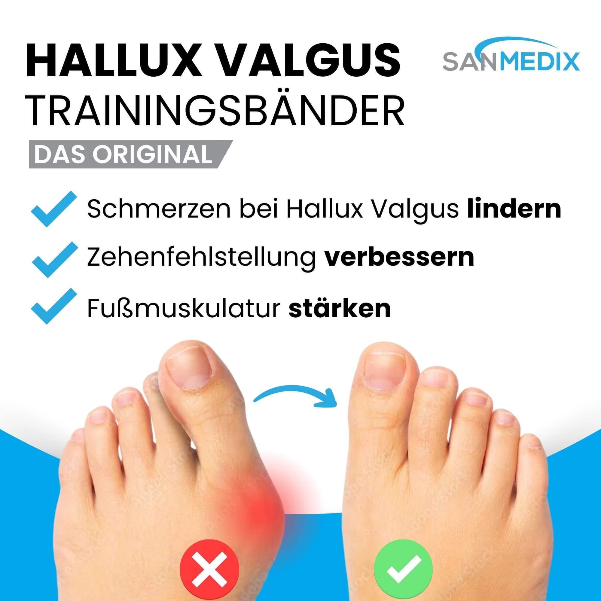 Sanmedix® Hallux Valgus Korrektur Trainingsbänder