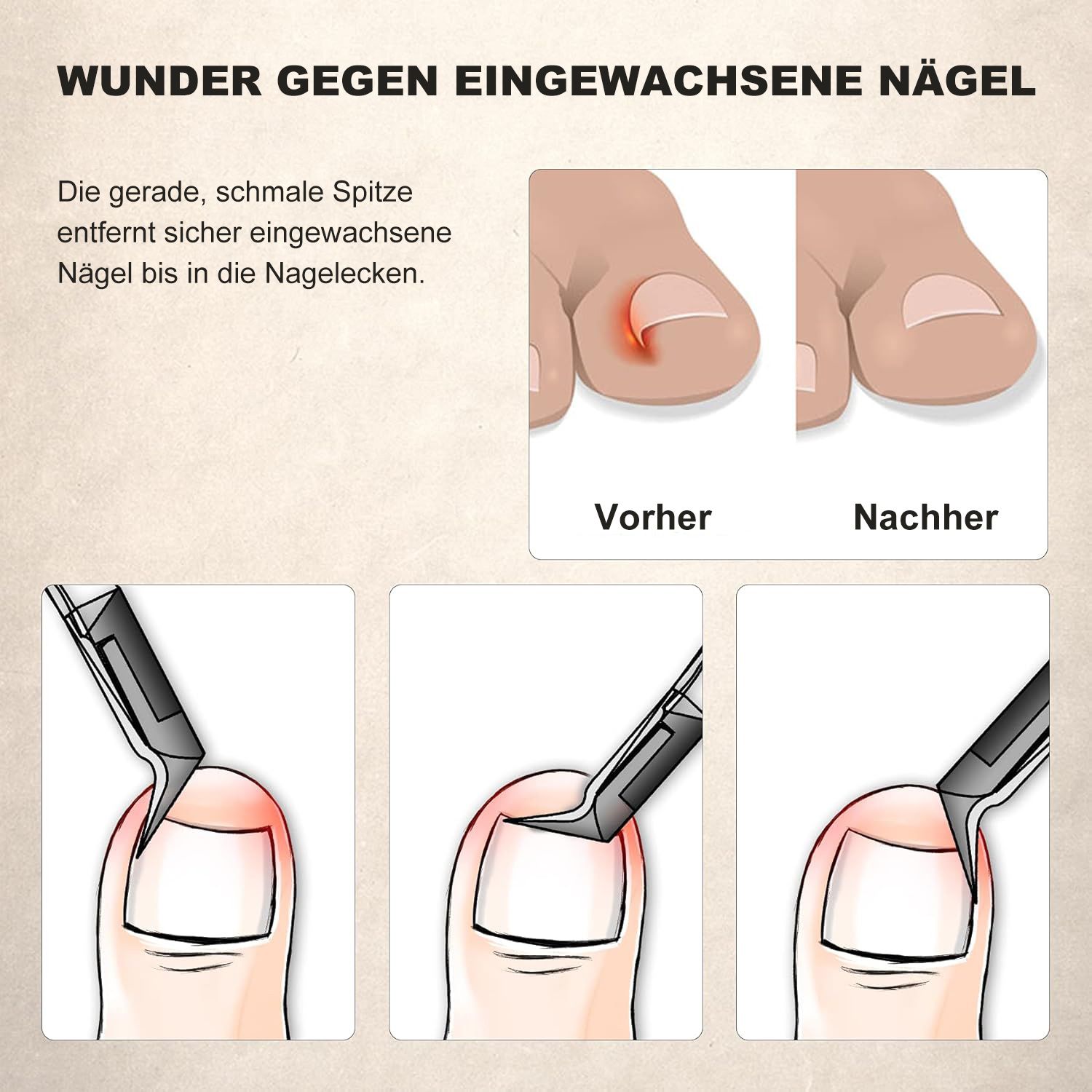 COOL-i Profi Nagelzange aus Edelstahl, Präzisions Fußnagelschere mit rutschfestem Griff