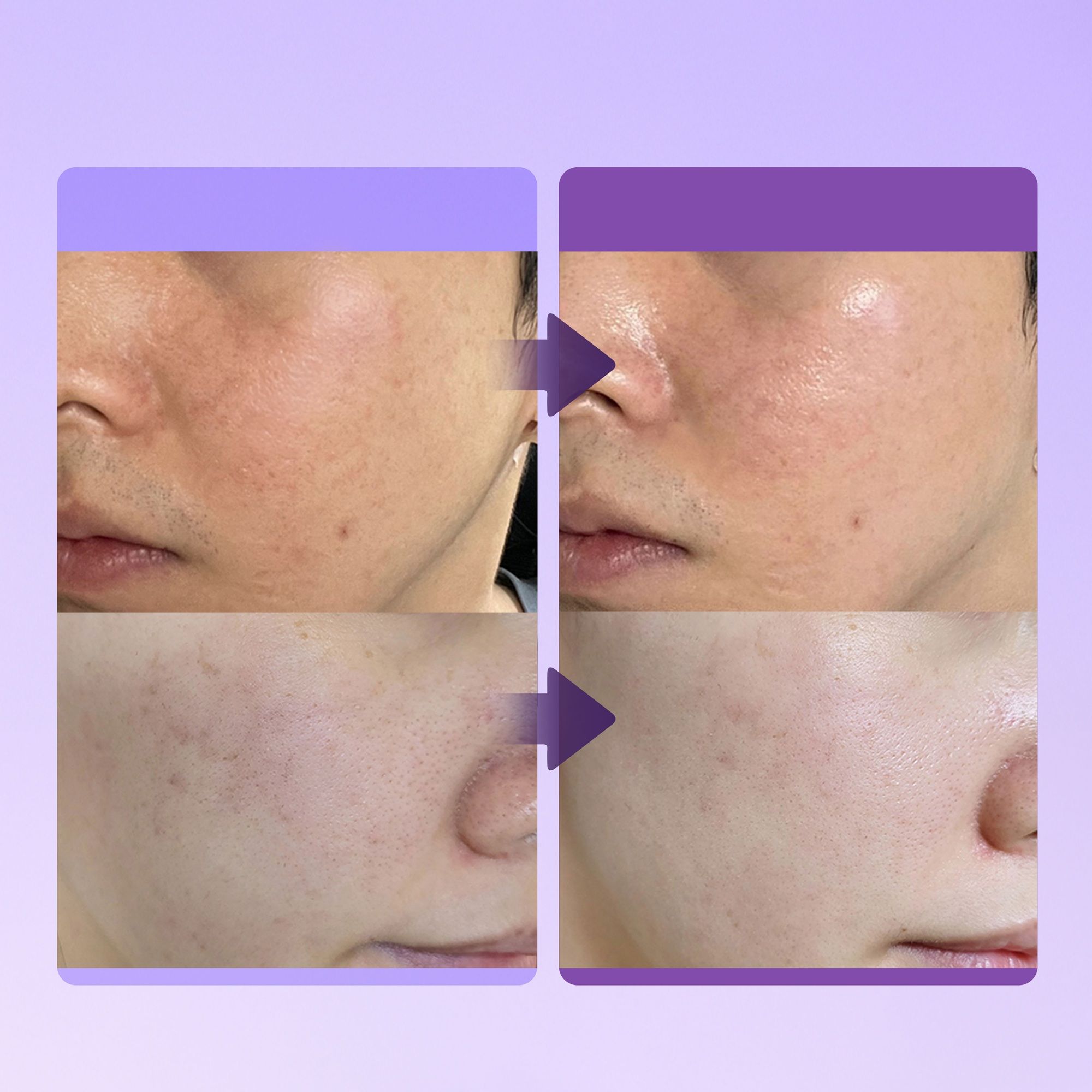 BE-HOPE Luxury Vegan Beruhigende Creme