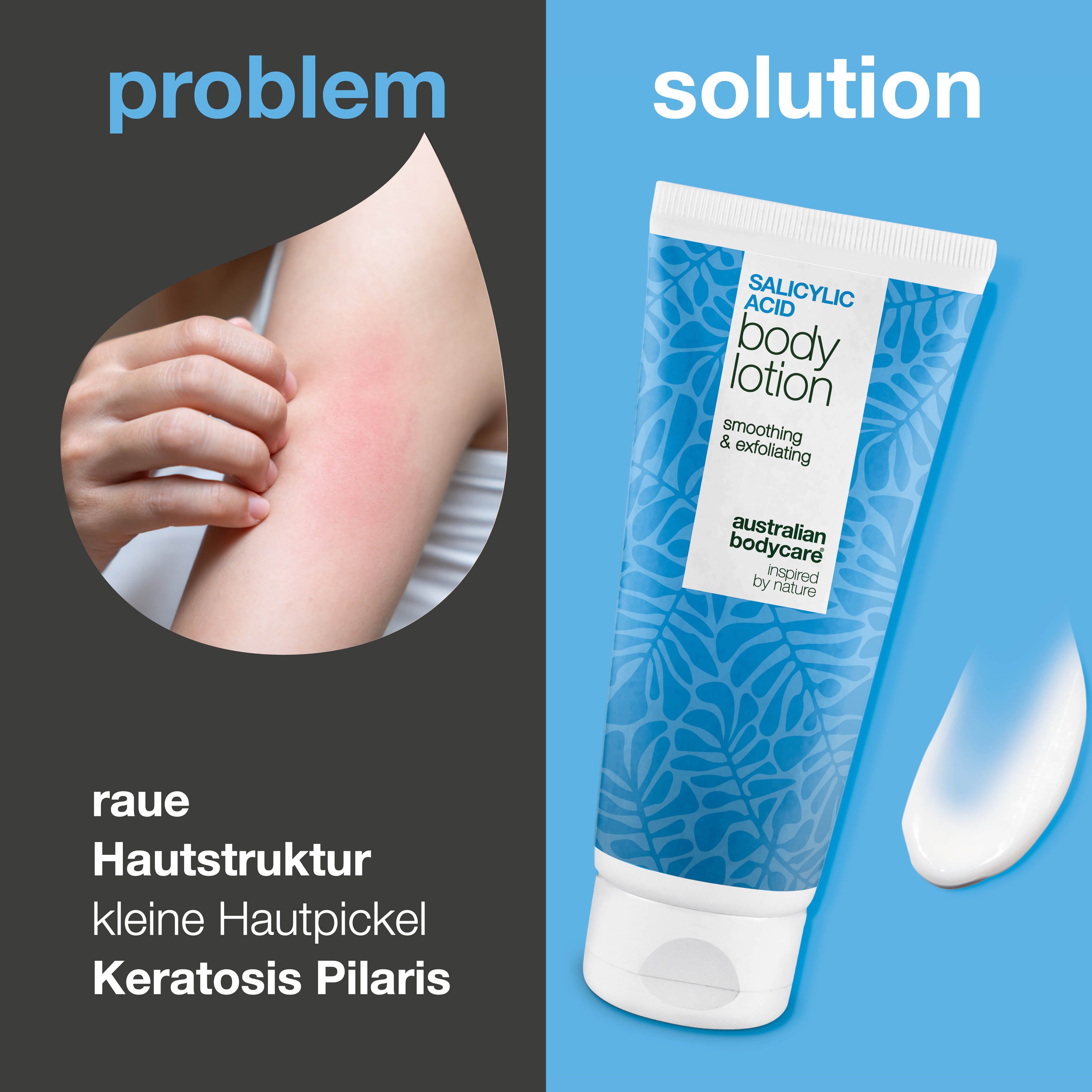 Vergleich: Arm mit Hautausschlag, daneben Tube "Salicylsäure Body Lotion".
