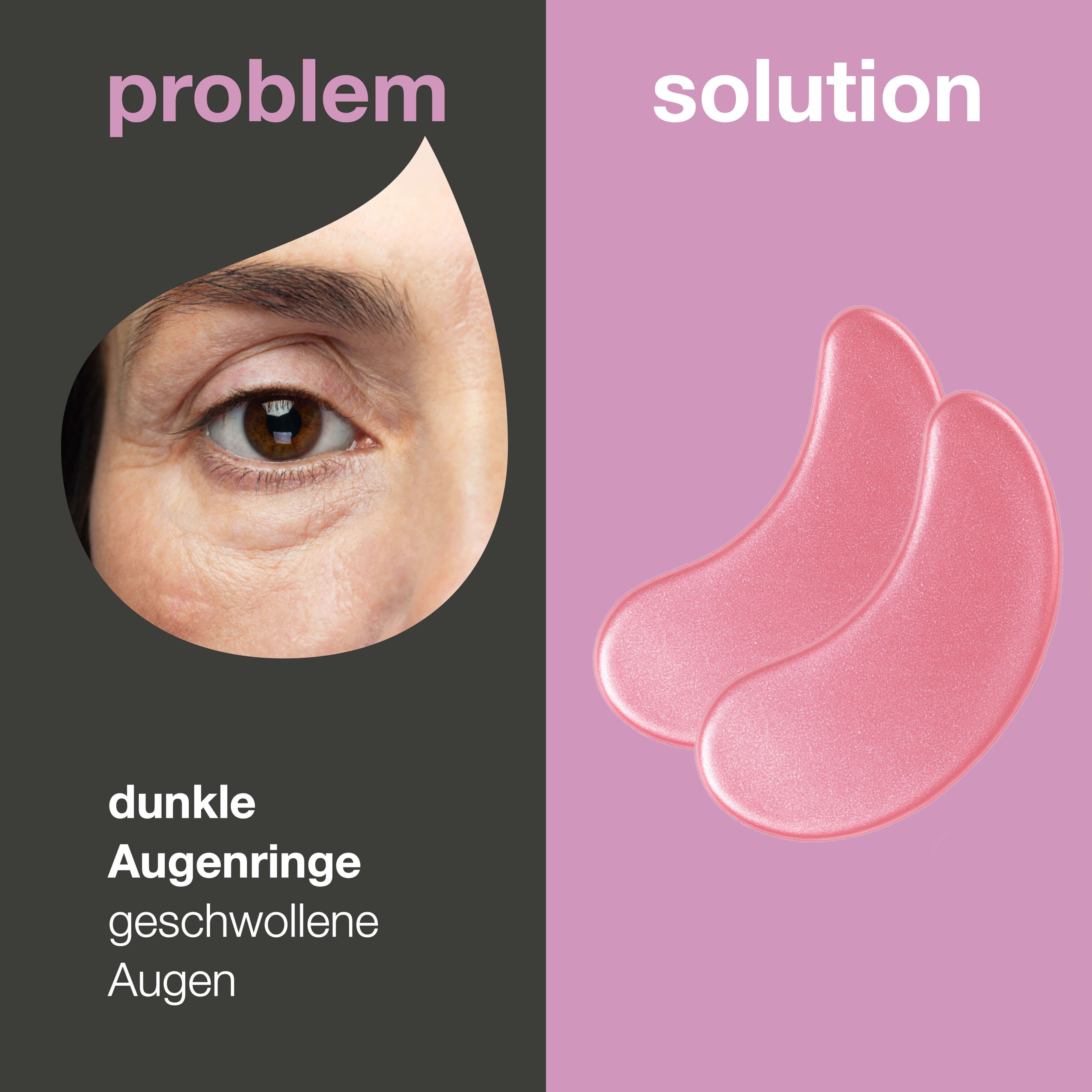Foto: Problem und Lösung. Links: Auge mit dunklen Augenringen. Rechts: Zwei rosa Augenpads.