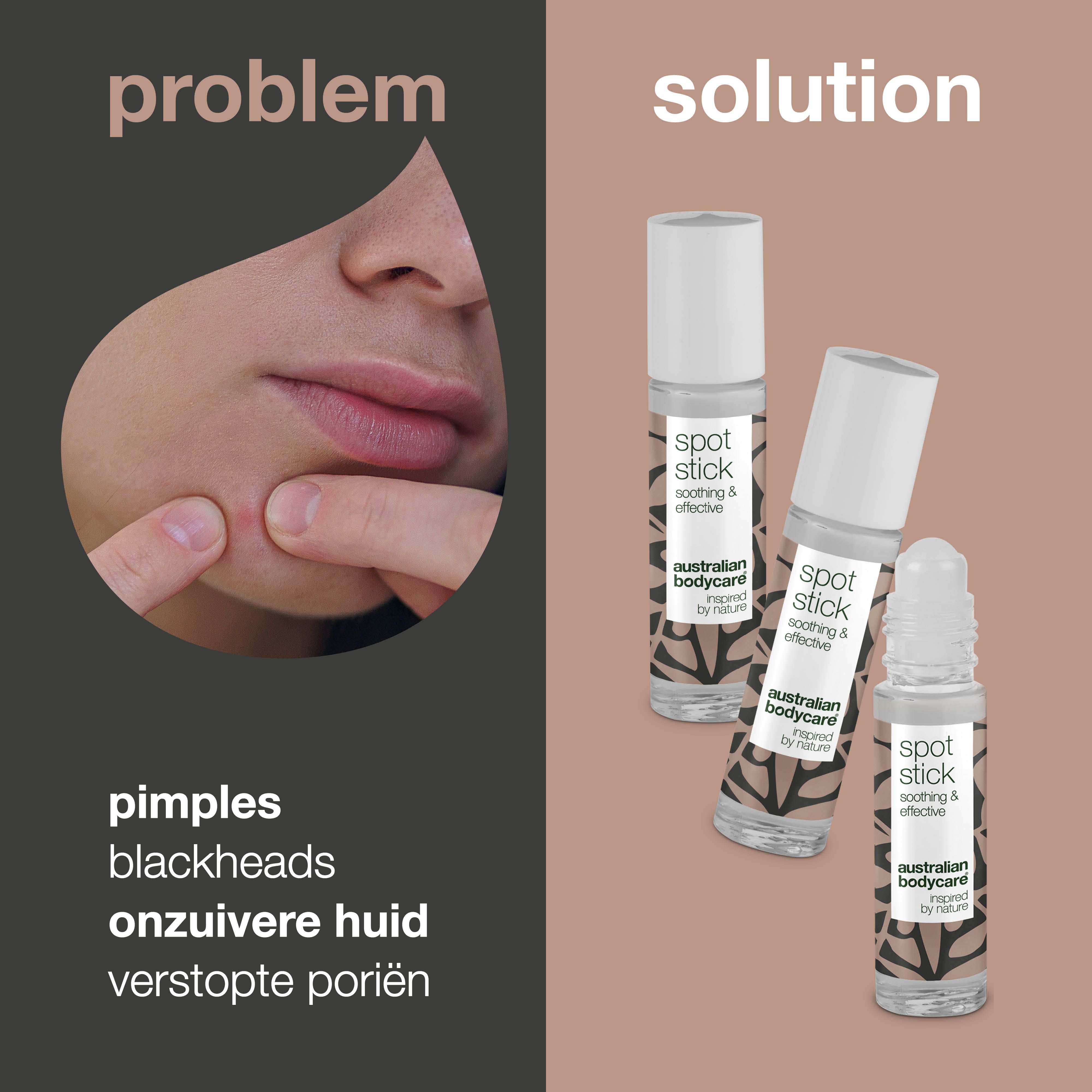 Probleem: puistjes, onzuivere huid. Oplossing: drie Spot Stick-flessen. Opschrift: Spot Stick, Australian Bodycare.