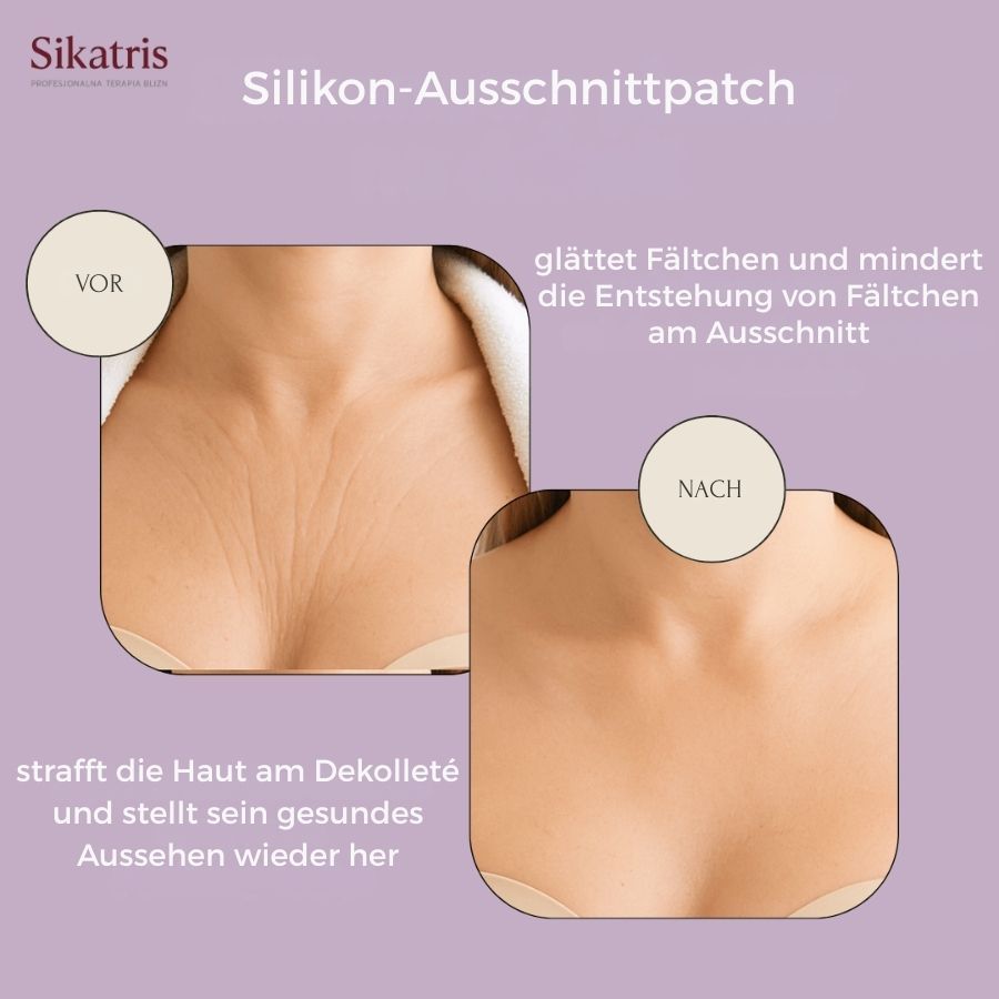 Vorher-Nachher-Vergleich: Dekolleté mit und ohne Falten. Text: Sikatris, glättet Falten, strafft Haut.