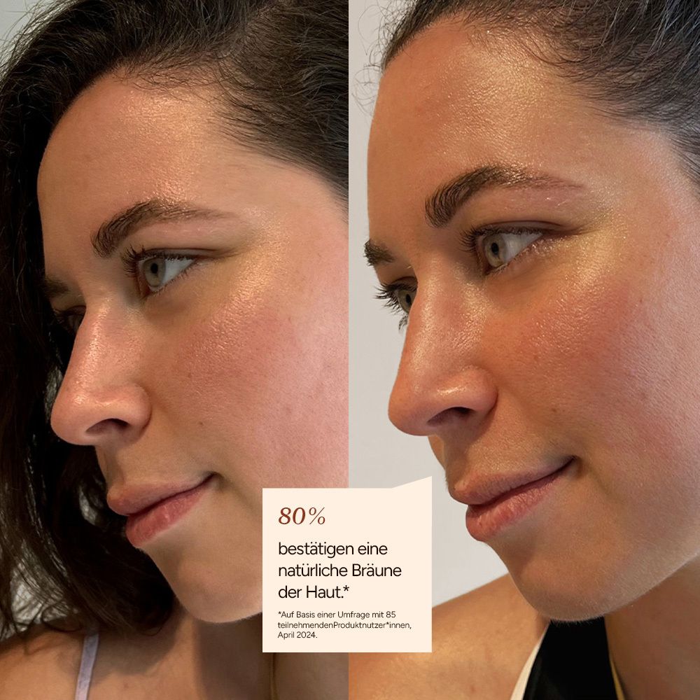 Gesicht einer Frau vor und nach der Anwendung. Text: 80% bestätigen eine natürliche Bräune der Haut.