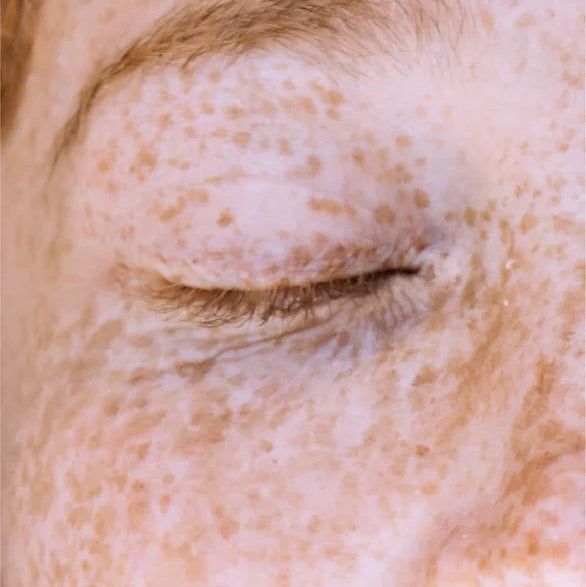 Zero Skin Renew & Glow Augen Serum, glättend aufhellend für müde Augenpartien