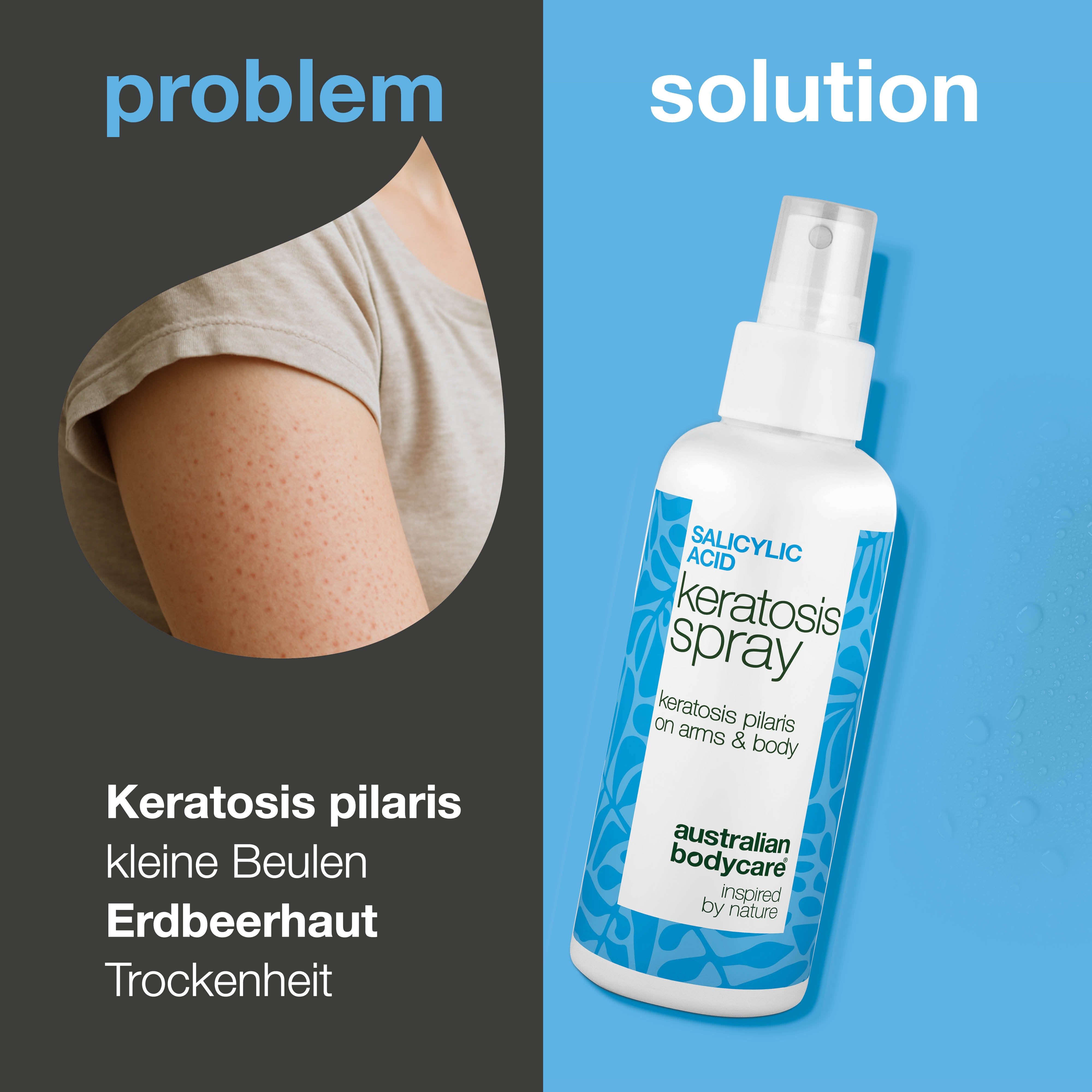 Arm mit Hautunreinheiten. Daneben Spray: Keratosis Spray, Australian Bodycare. Text: Problem, Lösung.