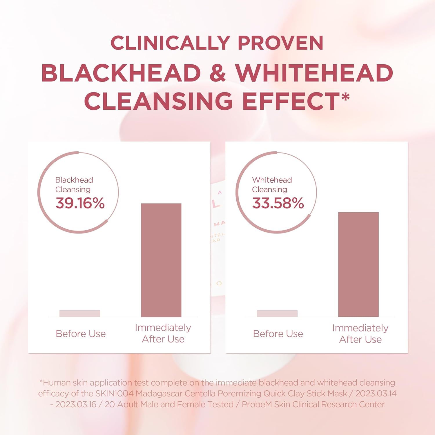 Diagramm mit Balken, die die Wirkung auf Mitesser und Whiteheads zeigen. Prozentsätze und Diagramme.