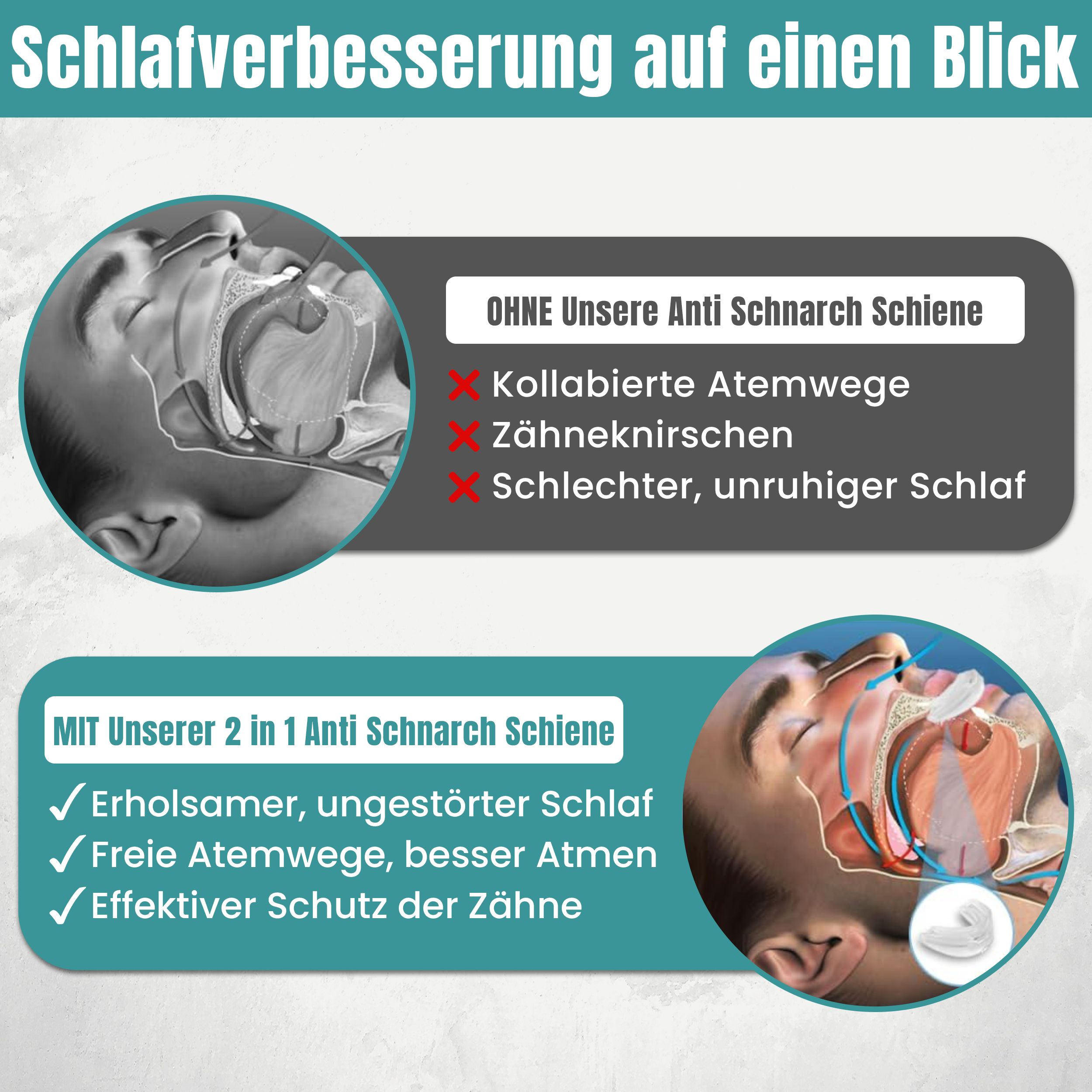 Ohne Anti-Schnarch-Schiene: kollabierte Atemwege, Zähneknirschen, schlechter Schlaf. Mit Schiene: erholsamer Schlaf, freie Atemwege, Schutz.