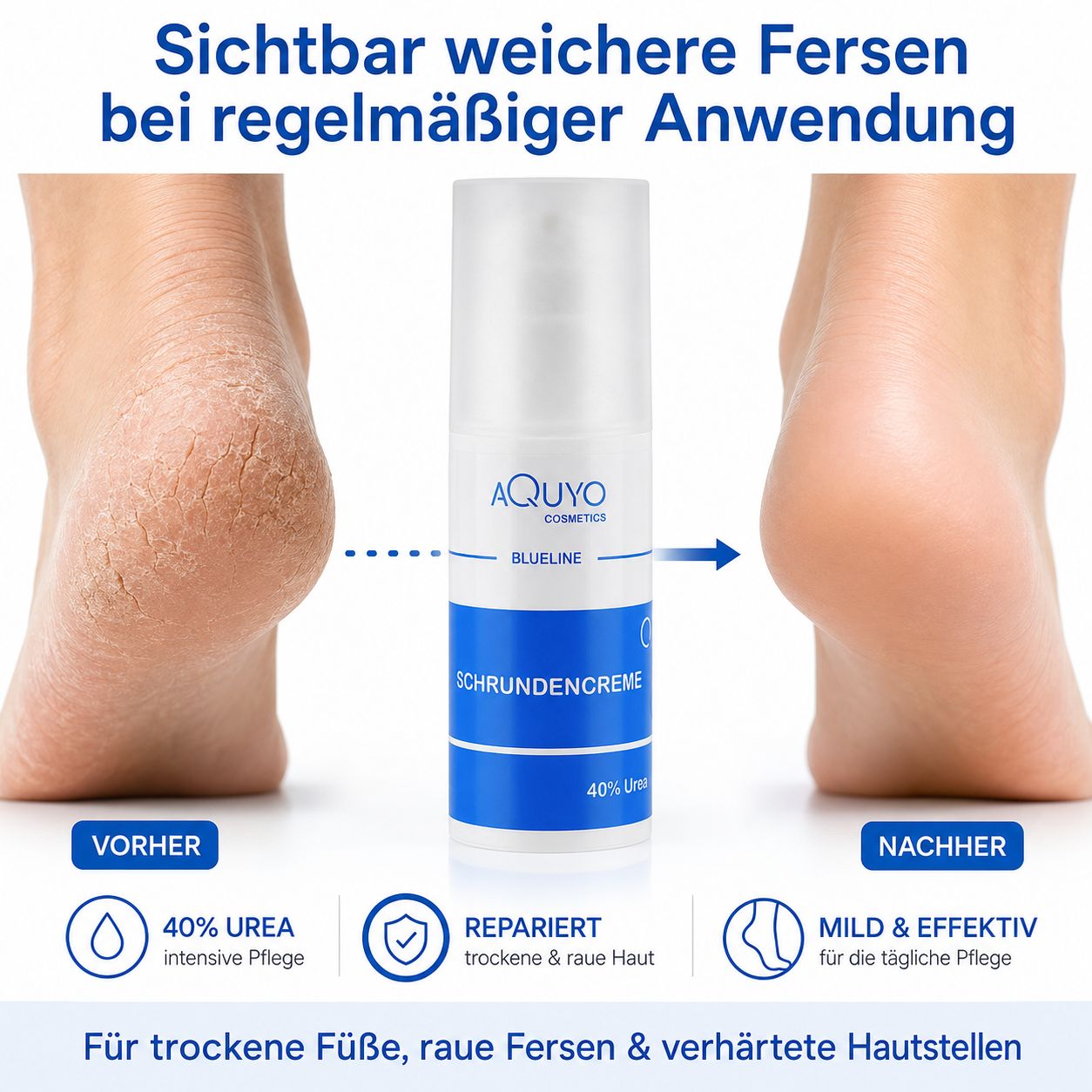 Fußcreme-Flakon, davor und danach Füße. Text: Sichtbar weichere Fersen bei regelmäßiger Anwendung. 40% Urea.