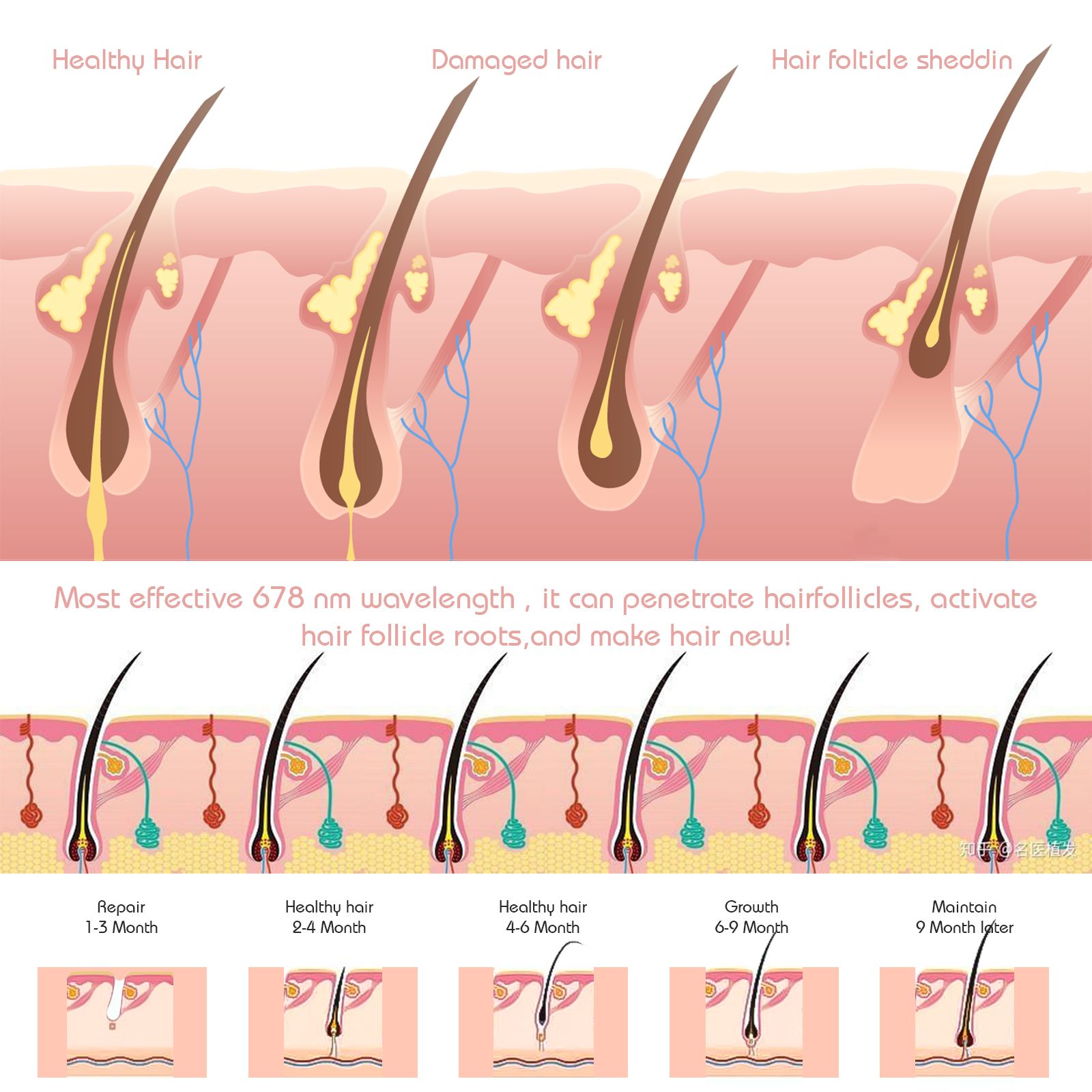 COOL-i LED Haarpflegehaube,158 LEDs, kabellos, mit Infrarot & Blaulicht, Timer, wiederaufladbar