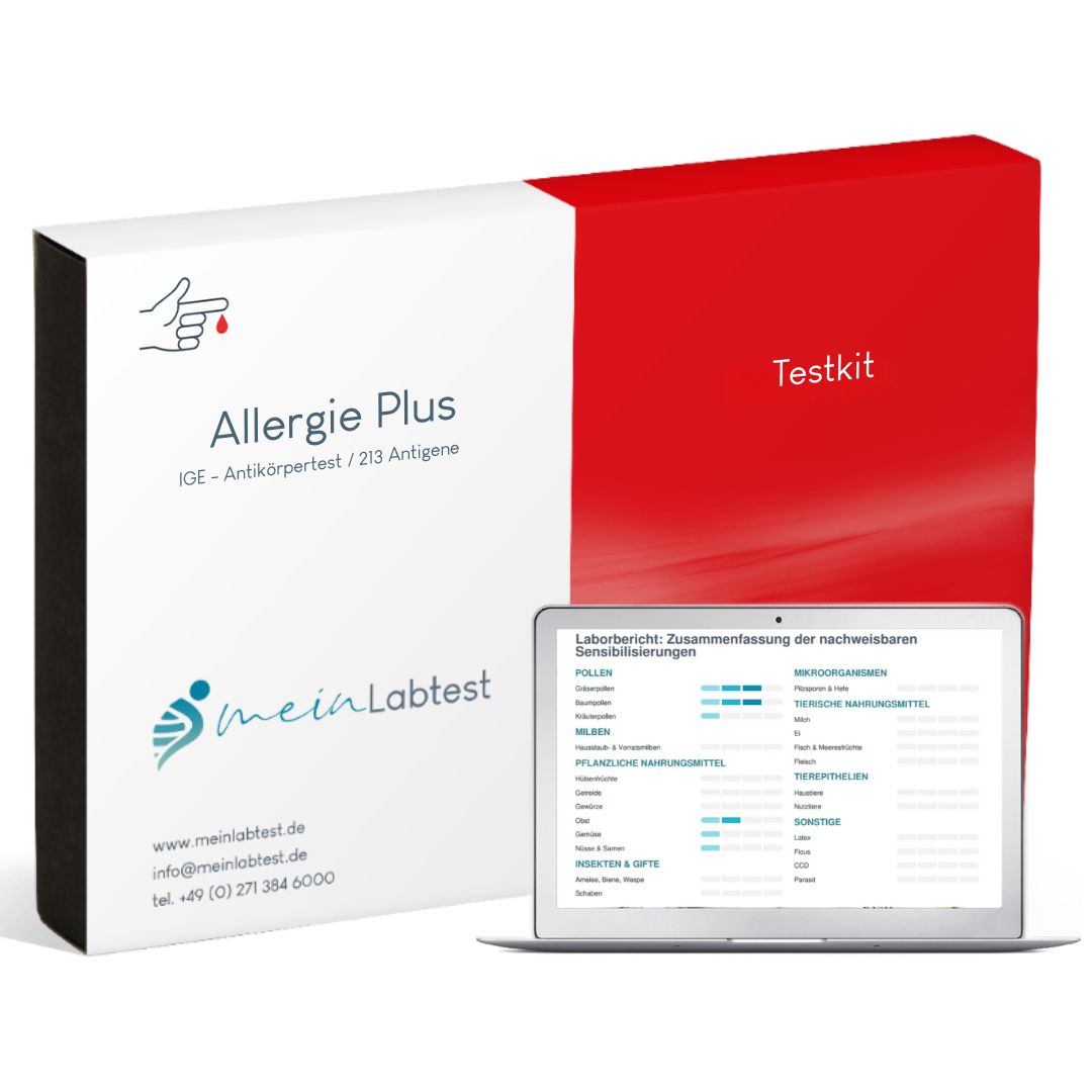 Meinlabtest Allergietest Plus. Box mit Testkit und Laptop mit Testergebnissen. Logo und Kontaktinformationen.