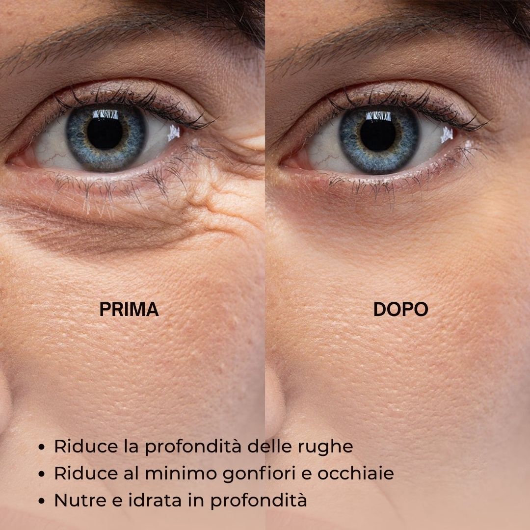 Confronto prima-dopo. Contorno occhi con rughe, poi pelle più liscia. Testo: Riduce la profondità delle rughe, minimizza i gonfiori.