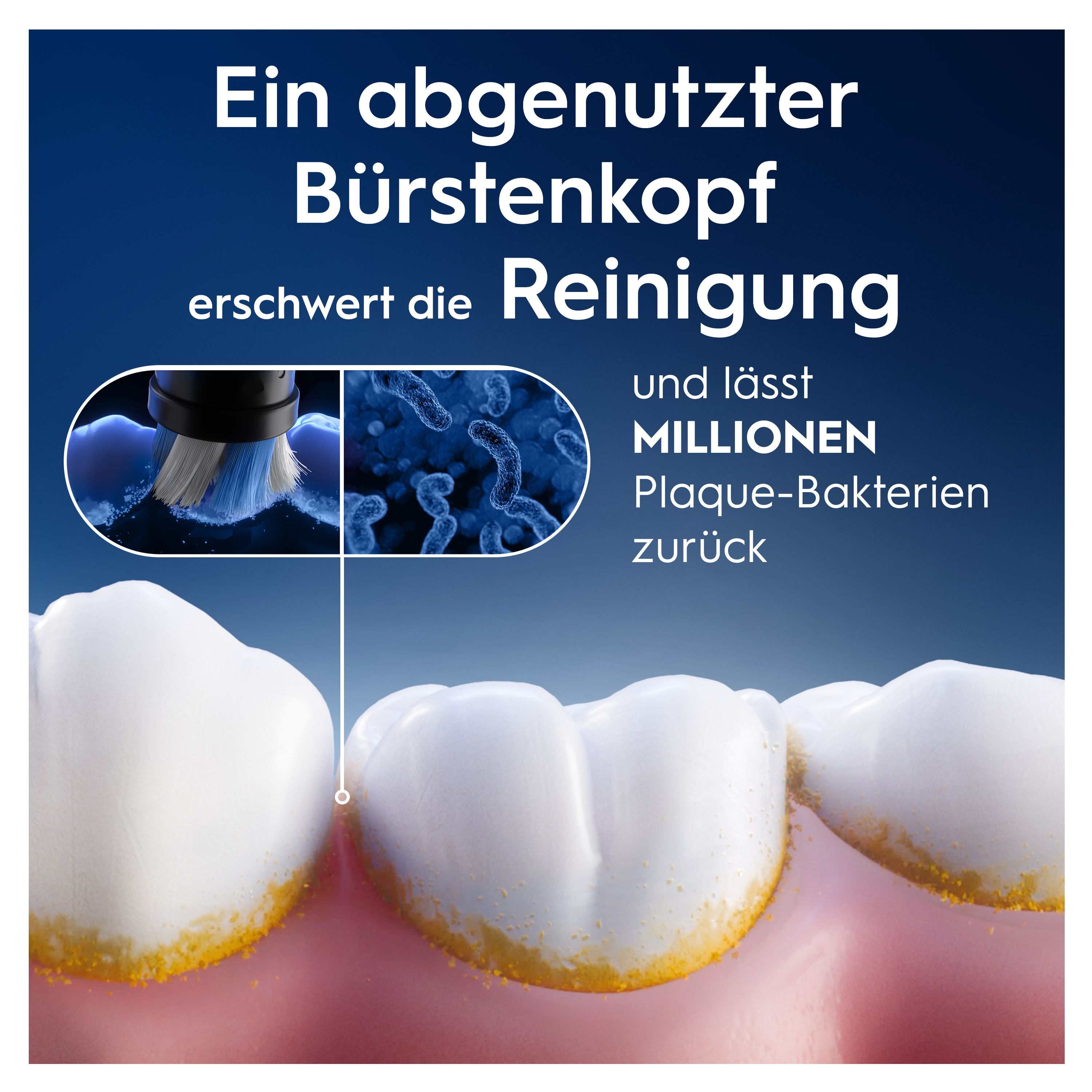 Zahnmodell mit Bakterien und einem Bürstenkopf. Text: Ein abgenutzter Bürstenkopf erschwert die Reinigung.