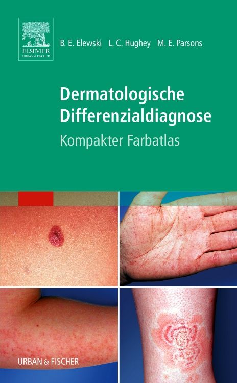 Buchcover: Dermatologische Differenzialdiagnose. Titel, Autoren, Logos von Elsevier und Urban & Fischer. Abbildungen von Hauterkrankungen.