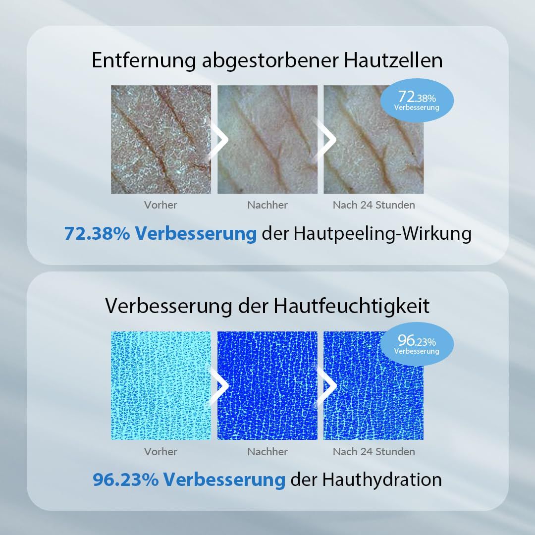 Vorher-Nachher-Vergleich. Hautpeeling-Wirkung: 72,38% Verbesserung. Verbesserung der Hautfeuchtigkeit: 96,23% Verbesserung.