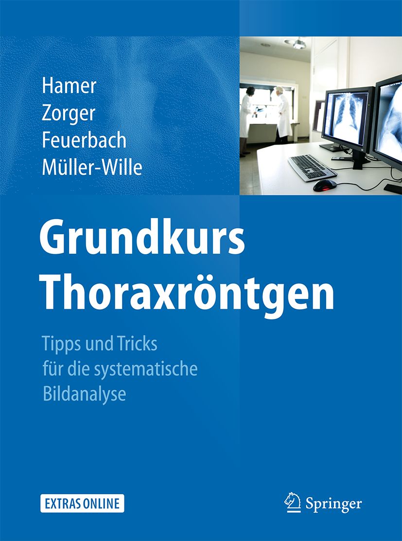 Buchcover: Grundkurs Thoraxröntgen. Autorennamen, Titel, Untertitel. Springer-Logo. Hintergrund: blau, Röntgenbilder auf Monitoren.