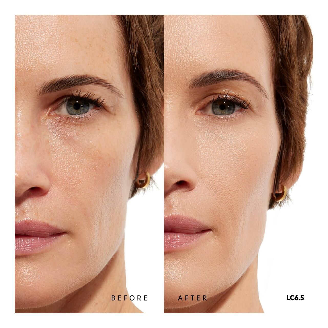 Gesicht einer Frau, geteilt in Vorher-Nachher-Ansicht. Linke Gesichtshälfte: Hautunreinheiten. Rechte Gesichtshälfte: ebenmäßiger Teint.