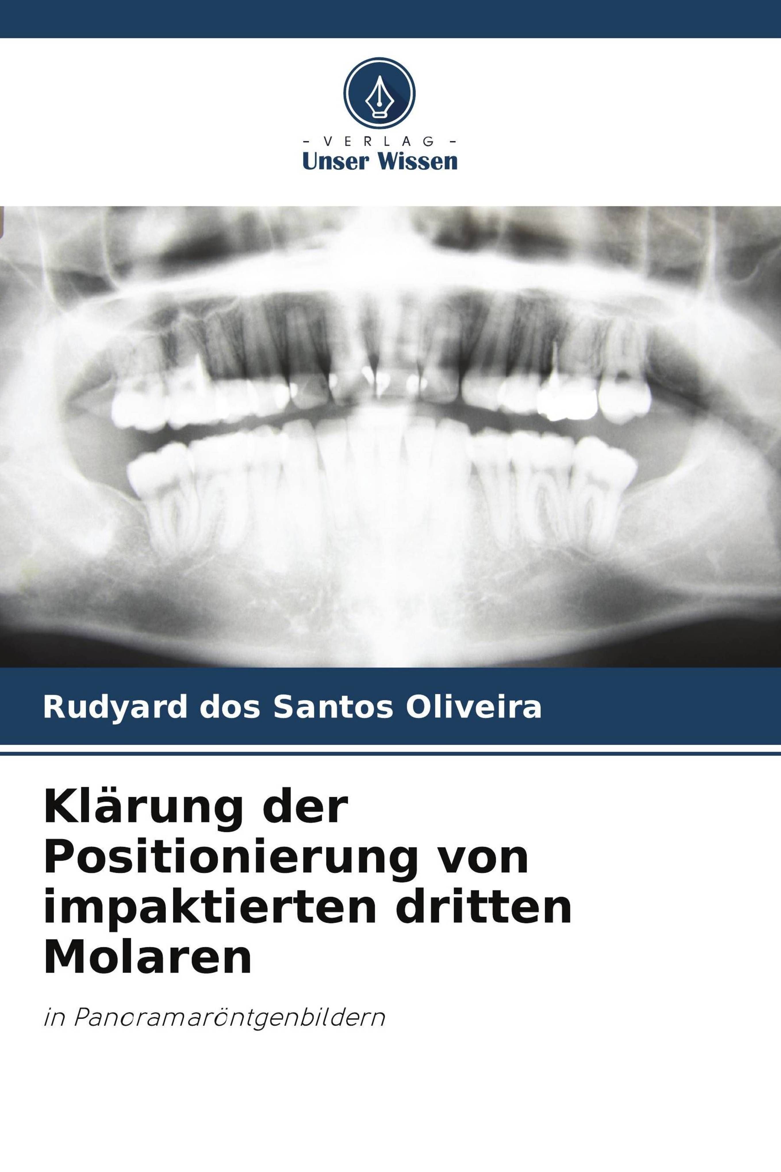 Klärung der Positionierung von impaktierten dritten Molaren in Panoramaröntgenbildern