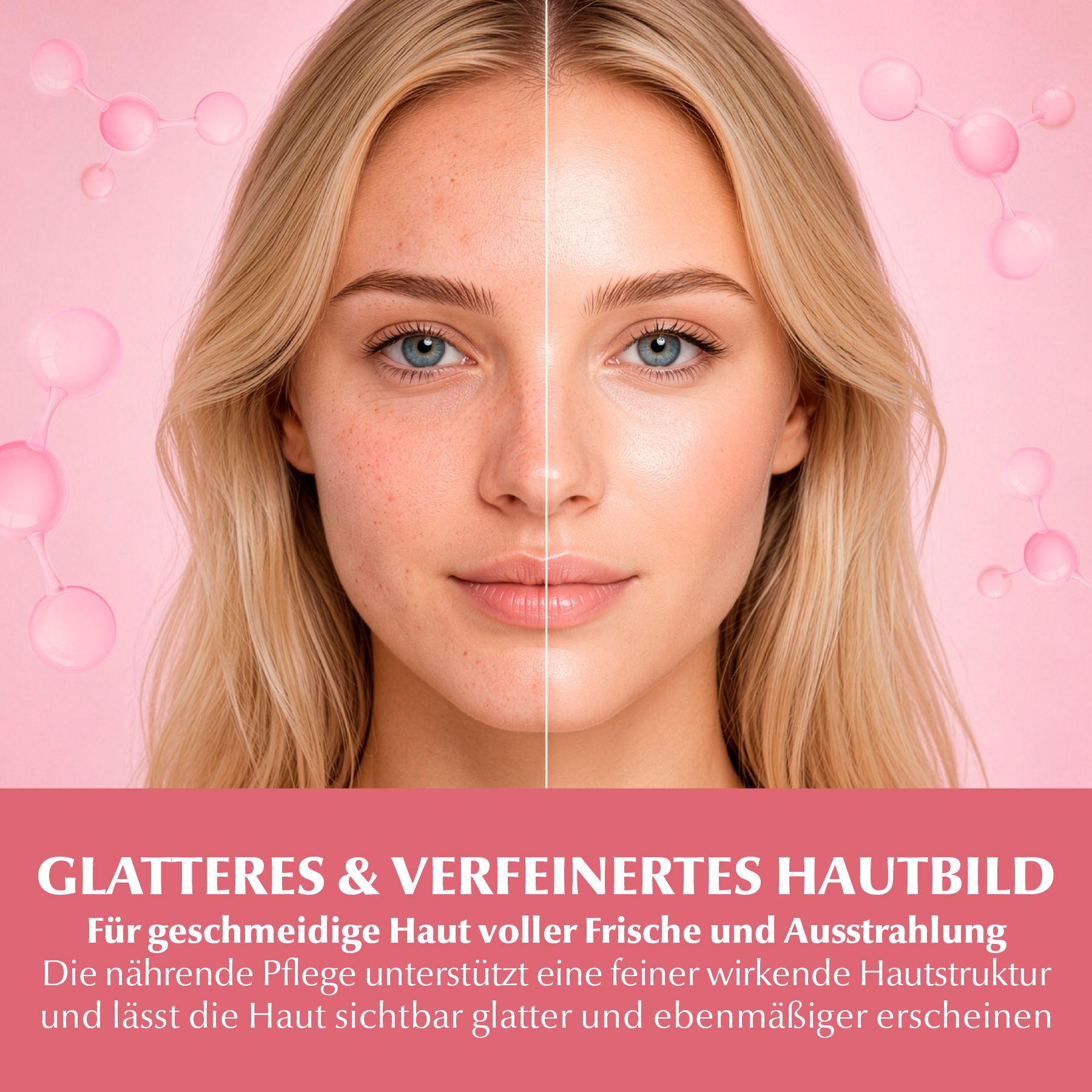 Vorher-Nachher-Vergleich einer Frau mit Hautproblemen, die durch die Anwendung von Dr. Rashel Niacinamide Moisturizer verbessert wird.