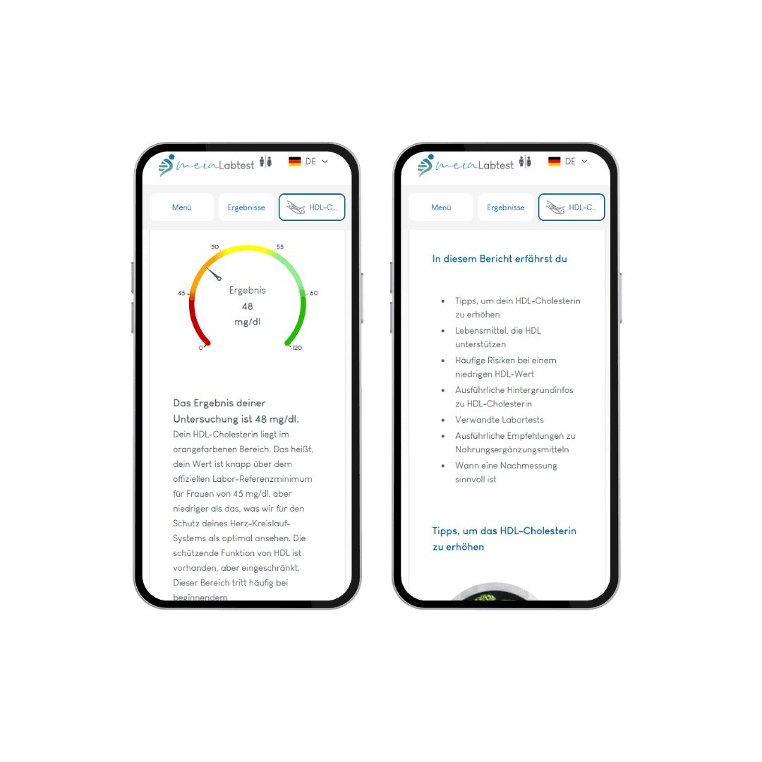 Zwei Smartphones mit Testergebnissen. Auf dem Bildschirm: Diagramme und Text. Logo: meinLabtest. Menü- und Ergebnisansicht.
