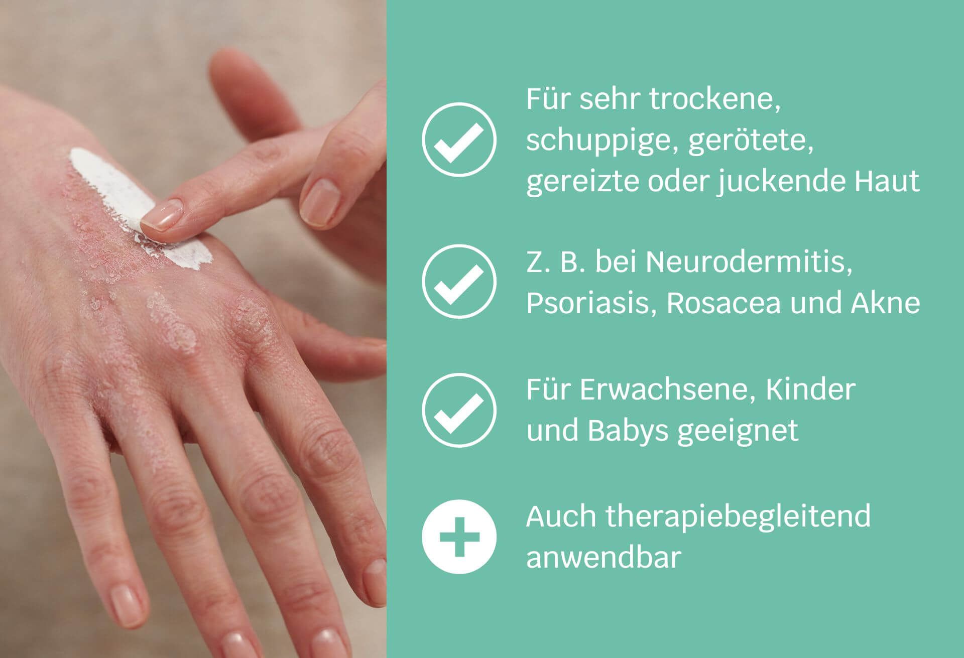 SIRIDERMA AKUT Intensivmaske ohne Duft